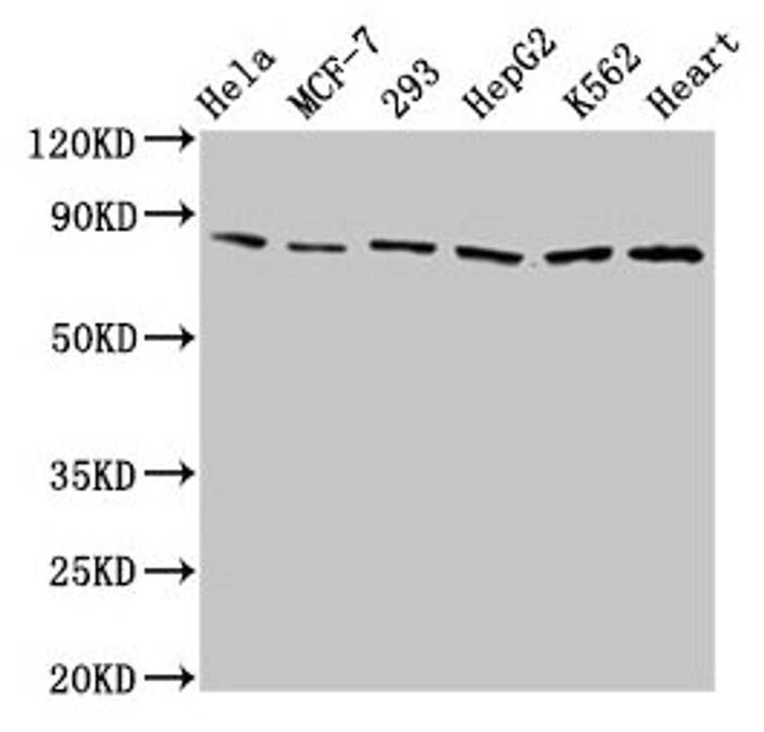 Western Blot. Positive WB detected in: Hela whole cell lysate, MCF-7 whole cell lysate, 293 whole cell lysate, HepG2 whole cell lysate, K562 whole cell lysate, Mouse heart tissue. All lanes: TRAP1 antibody at 2µg/ml. Secondary. Goat polyclonal to rabbit IgG at 1/50000 dilution. Predicted band size: 81, 75 kDa. Observed band size: 81 kDa