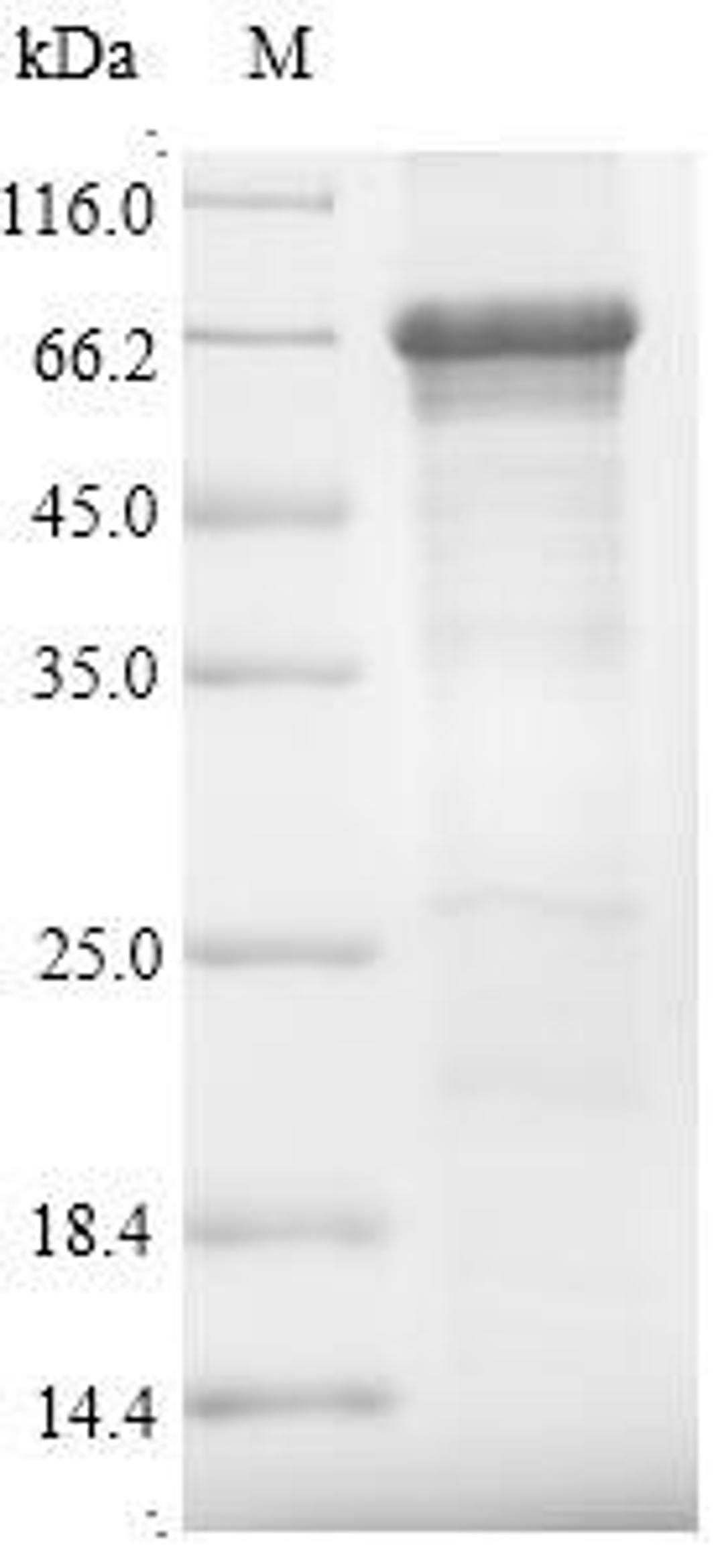(Tris-Glycine gel) Discontinuous SDS-PAGE (reduced) with 5% enrichment gel and 15% separation gel.