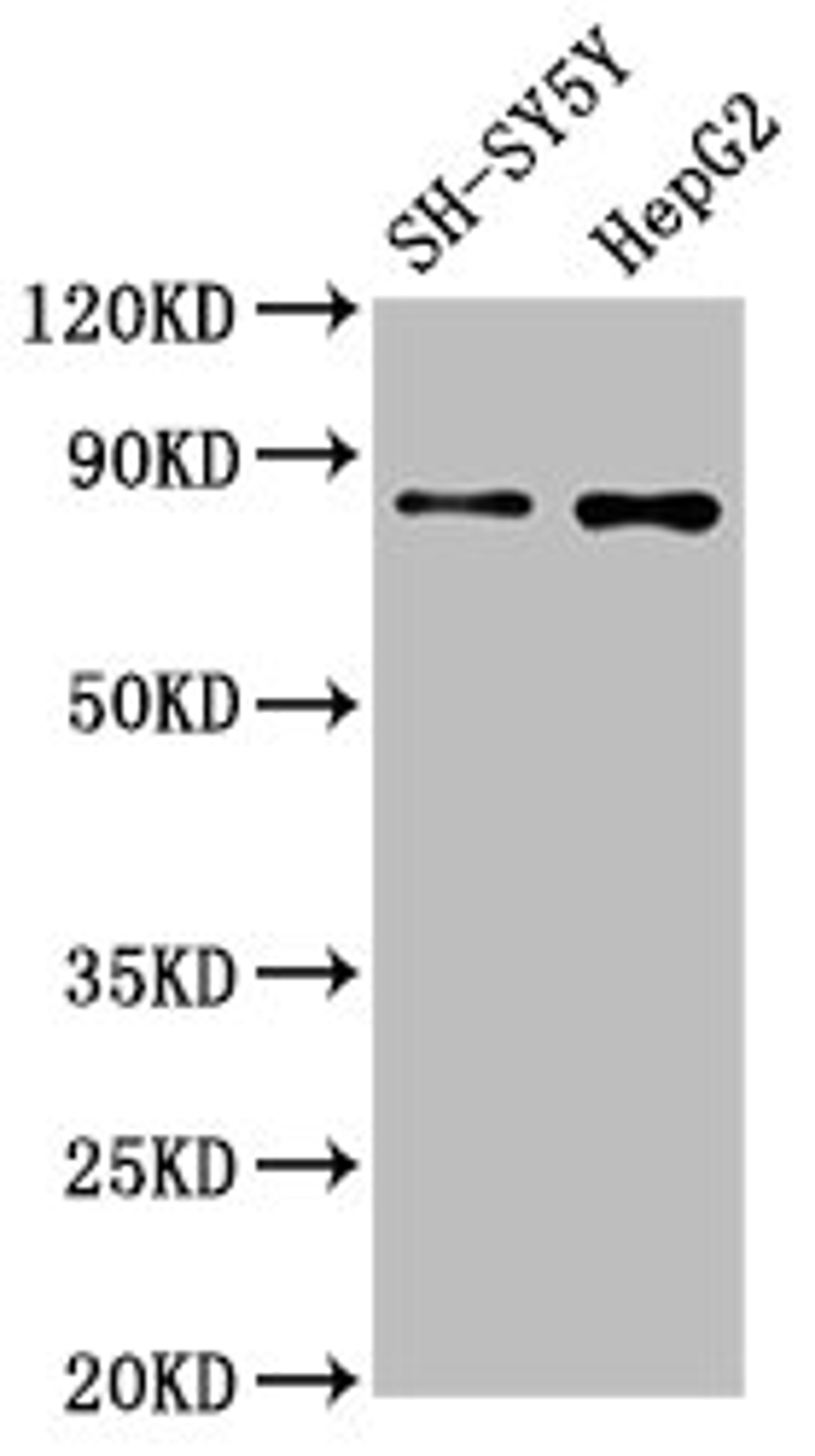 Western Blot. Positive WB detected in: SH-SY5Y whole cell lysate, HepG2 whole cell lysate. All lanes: GOLM1 antibody at 1.3μg/ml. Secondary. Goat polyclonal to rabbit IgG at 1/50000 dilution. Predicted band size: 46, 45 KDa. Observed band size: 80 KDa. 