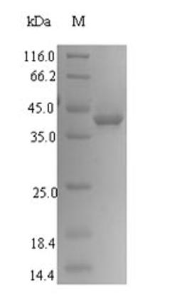 (Tris-Glycine gel) Discontinuous SDS-PAGE (reduced) with 5% enrichment gel and 15% separation gel.