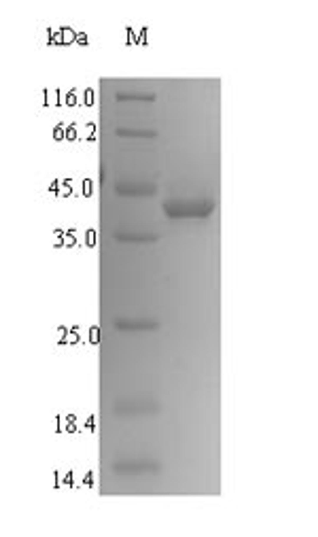 (Tris-Glycine gel) Discontinuous SDS-PAGE (reduced) with 5% enrichment gel and 15% separation gel.