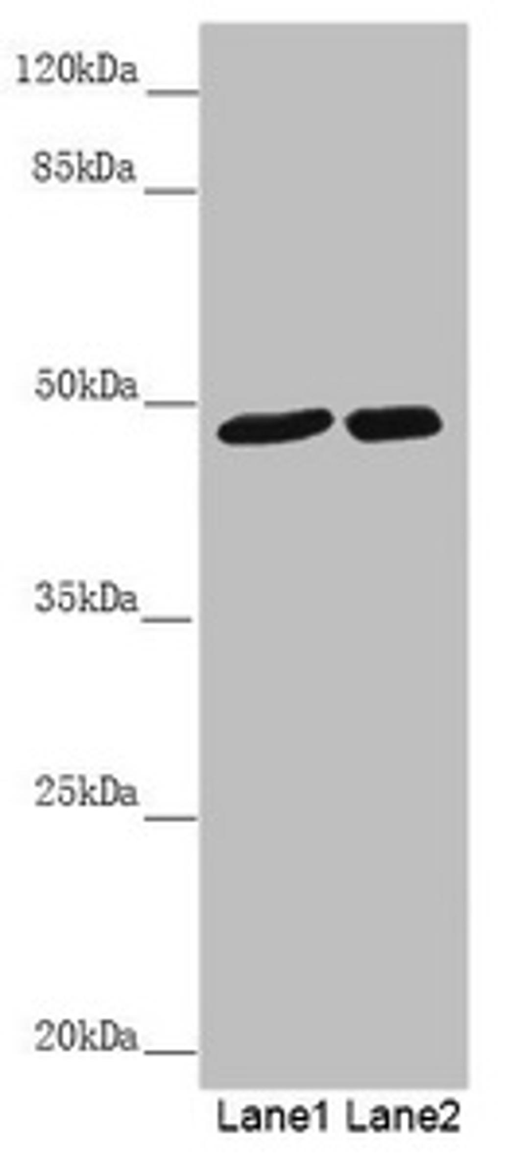 Western blot. All lanes: PSTPIP1 antibody at 0.85 ug/ml. Lane 1: Mouse brain tissue. Lane 2: Raw264.7 whole cell lysate. Secondary. Goat polyclonal to rabbit IgG at 1/10000 dilution. Predicted band size: 48, 46 kDa. Observed band size: 48 kDa. 