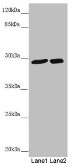 Western blot. All lanes: PSTPIP1 antibody at 0.85 ug/ml. Lane 1: Mouse brain tissue. Lane 2: Raw264.7 whole cell lysate. Secondary. Goat polyclonal to rabbit IgG at 1/10000 dilution. Predicted band size: 48, 46 kDa. Observed band size: 48 kDa. 
