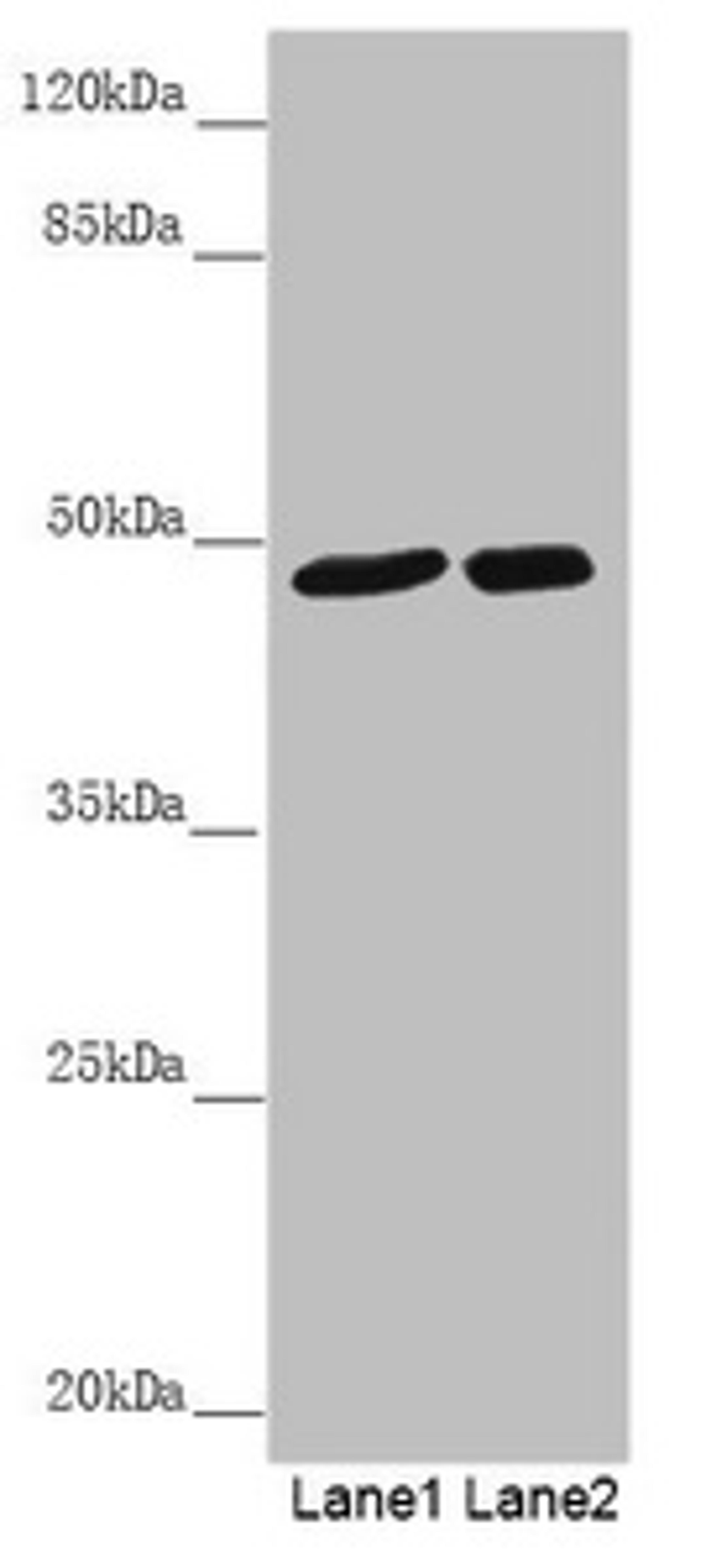 Western blot. All lanes: PSTPIP1 antibody at 0.85 ug/ml. Lane 1: Mouse brain tissue. Lane 2: Raw264.7 whole cell lysate. Secondary. Goat polyclonal to rabbit IgG at 1/10000 dilution. Predicted band size: 48, 46 kDa. Observed band size: 48 kDa. 