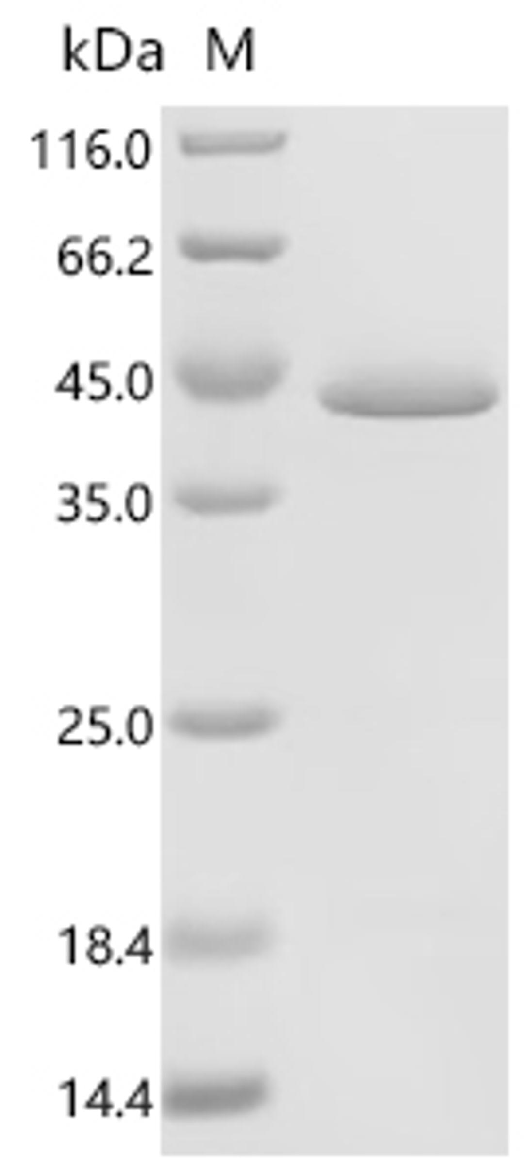 (Tris-Glycine gel) Discontinuous SDS-PAGE (reduced) with 5% enrichment gel and 15% separation gel.