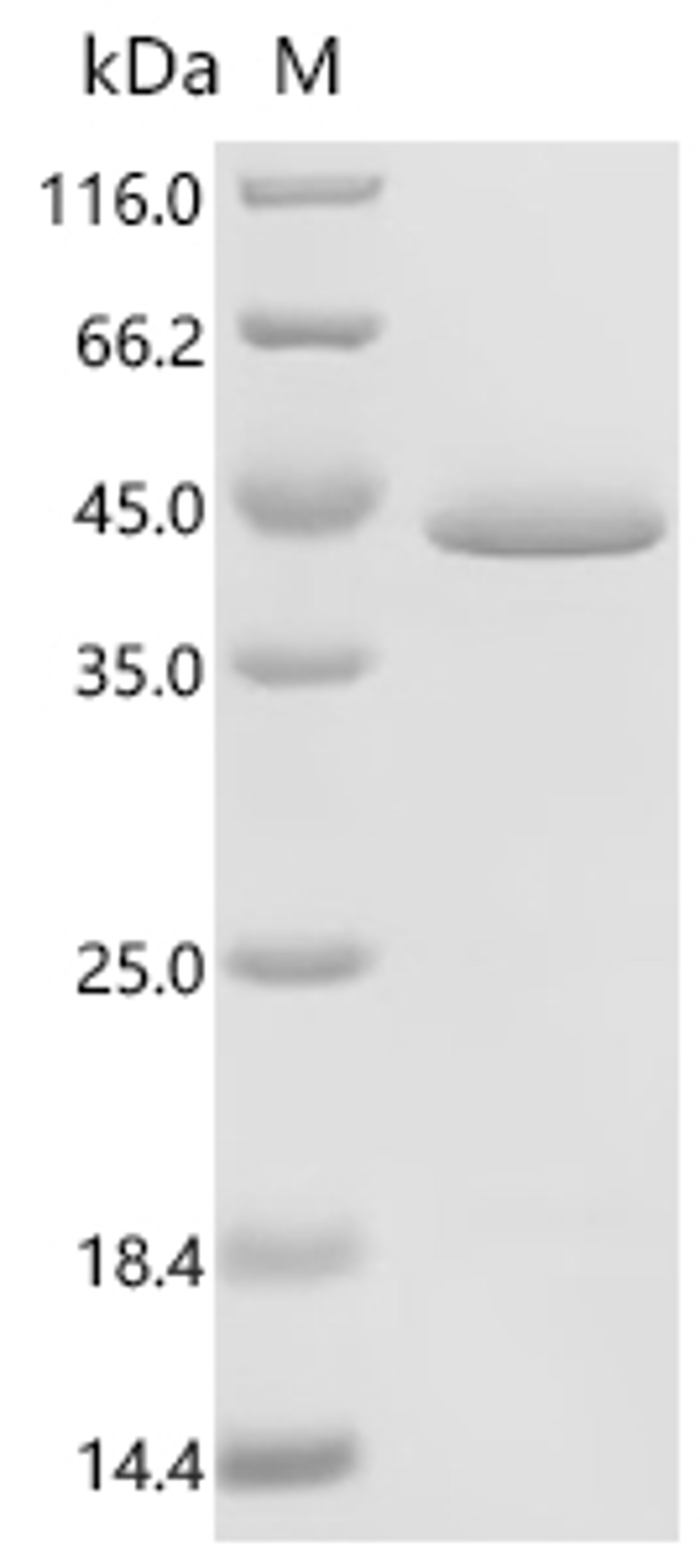 (Tris-Glycine gel) Discontinuous SDS-PAGE (reduced) with 5% enrichment gel and 15% separation gel.