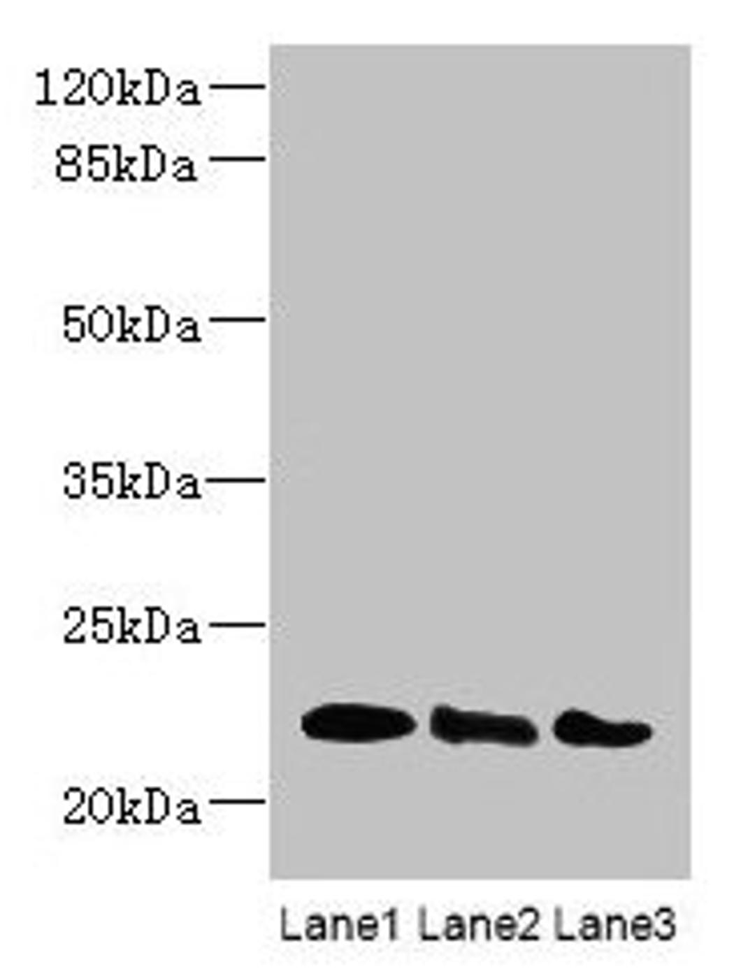Western blot. All lanes: ARL8B antibody at 4µg/ml. Lane 1: Mouse brain tissue. Lane 2: NIH/3T3 whole cell lysate. Lane 3: Jurkat whole cell lysate. Secondary. Goat polyclonal to rabbit IgG at 1/10000 dilution. Predicted band size: 22, 19 kDa. Observed band size: 22 kDa