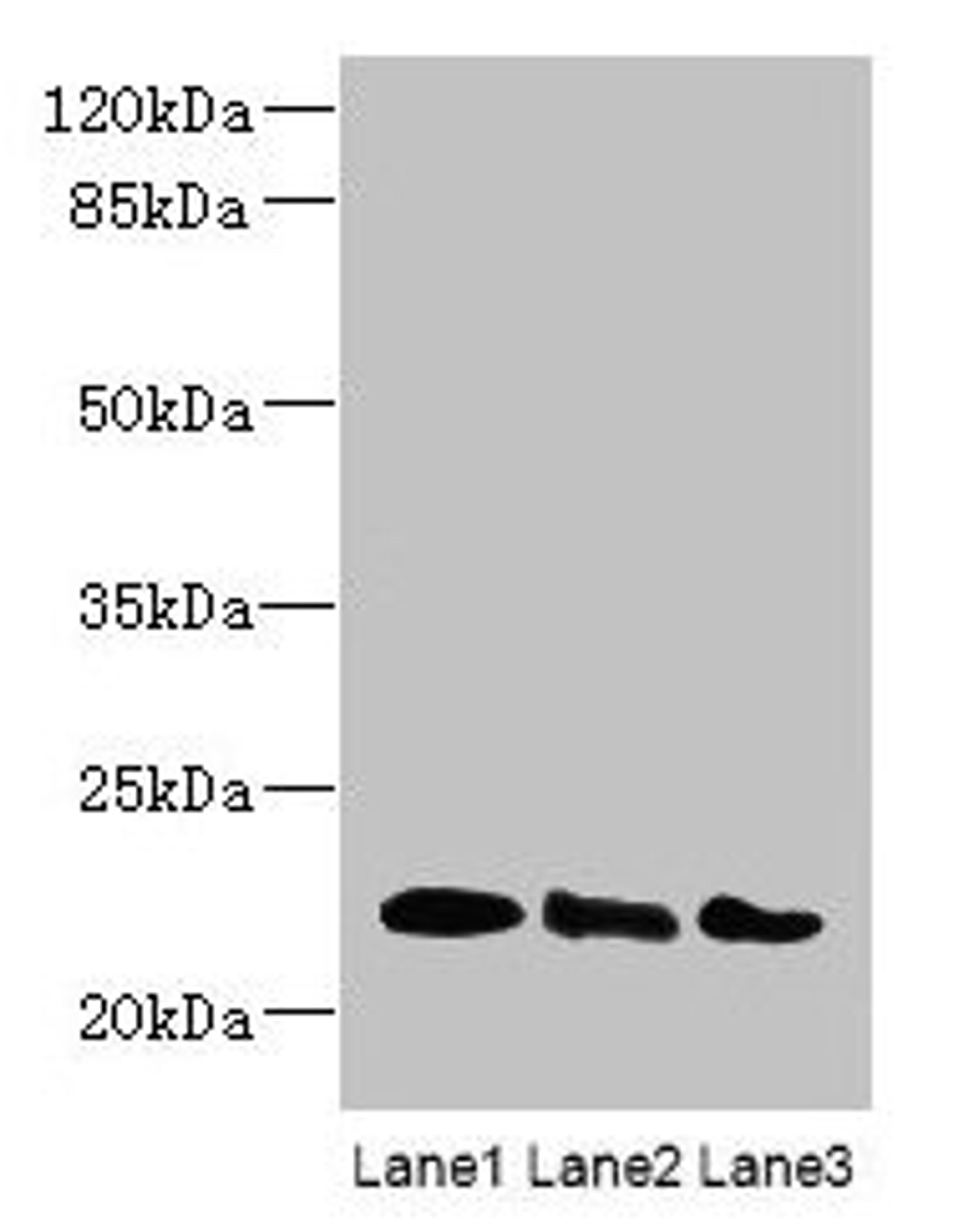 Western blot. All lanes: ARL8B antibody at 4µg/ml. Lane 1: Mouse brain tissue. Lane 2: NIH/3T3 whole cell lysate. Lane 3: Jurkat whole cell lysate. Secondary. Goat polyclonal to rabbit IgG at 1/10000 dilution. Predicted band size: 22, 19 kDa. Observed band size: 22 kDa