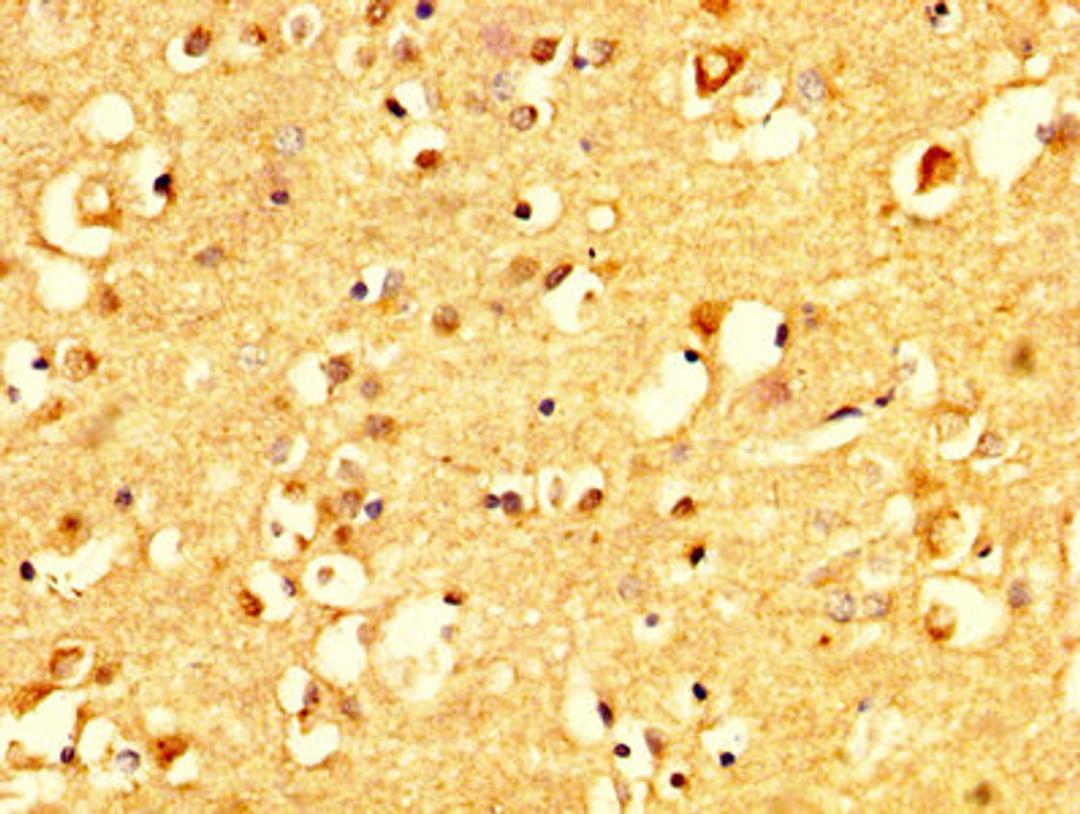 IHC image of CSB-PA005965YA01HU diluted at 1:500 and staining in paraffin-embedded human brain tissue performed on a Leica BondTM system. After dewaxing and hydration, antigen retrieval was mediated by high pressure in a citrate buffer (pH 6.0). Section was blocked with 10% normal goat serum 30min at RT. Then primary antibody (1% BSA) was incubated at 4&deg;C overnight. The primary is detected by a biotinylated secondary antibody and visualized using an HRP conjugated SP system.