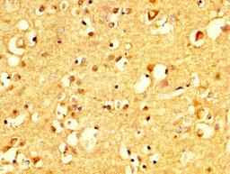 IHC image of CSB-PA005965YA01HU diluted at 1:500 and staining in paraffin-embedded human brain tissue performed on a Leica BondTM system. After dewaxing and hydration, antigen retrieval was mediated by high pressure in a citrate buffer (pH 6.0). Section was blocked with 10% normal goat serum 30min at RT. Then primary antibody (1% BSA) was incubated at 4&deg;C overnight. The primary is detected by a biotinylated secondary antibody and visualized using an HRP conjugated SP system.