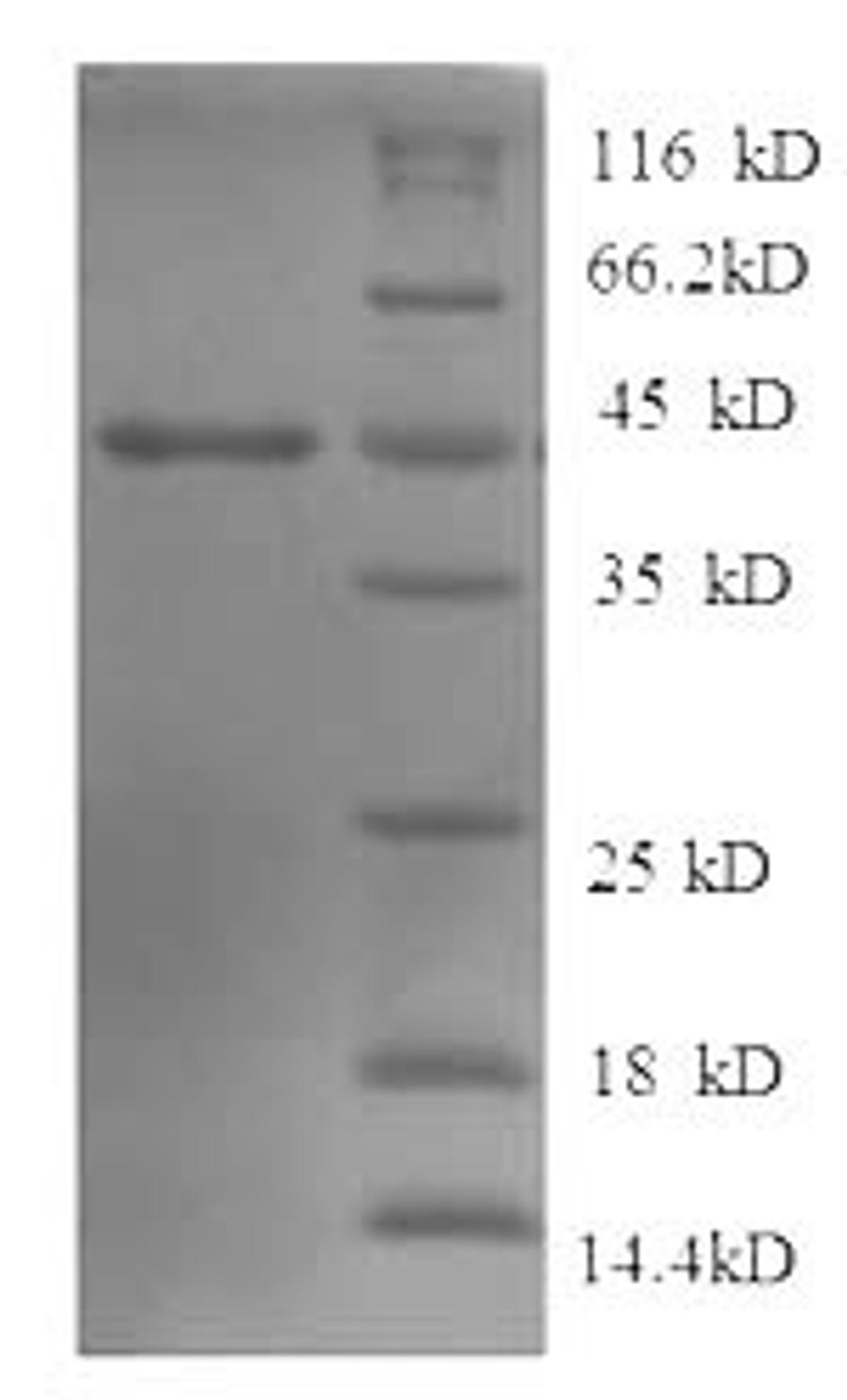 (Tris-Glycine gel) Discontinuous SDS-PAGE (reduced) with 5% enrichment gel and 15% separation gel.