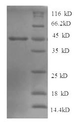 (Tris-Glycine gel) Discontinuous SDS-PAGE (reduced) with 5% enrichment gel and 15% separation gel.