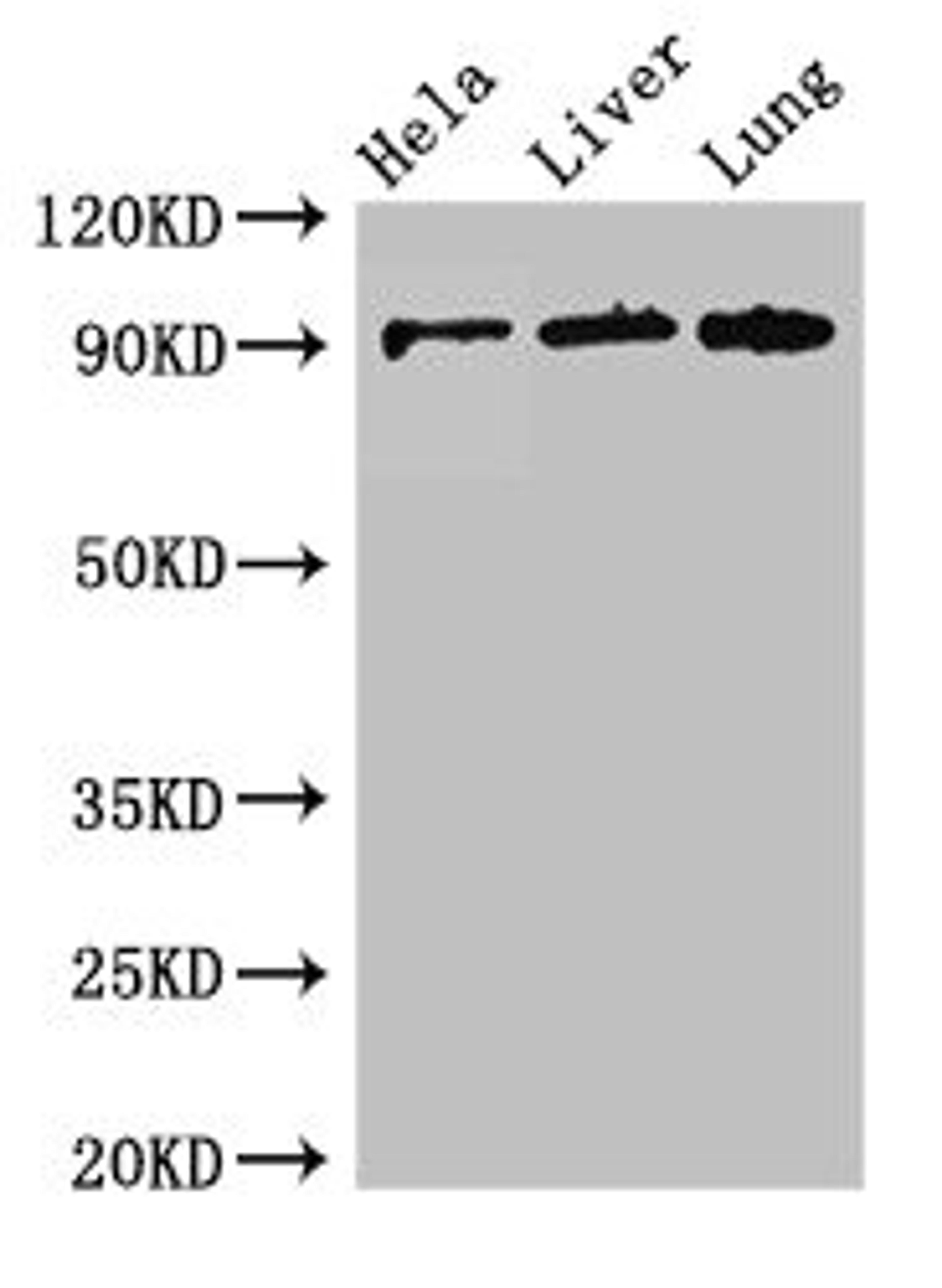 Western Blot. Positive WB detected in: Hela whole cell lysate, Mouse liver tissue, Mouse lung tissue. All lanes: CPT1C antibody at 2.6µg/ml. Secondary. Goat polyclonal to rabbit IgG at 1/50000 dilution. Predicted band size: 91, 90, 81 kDa. Observed band size: 91 kDa