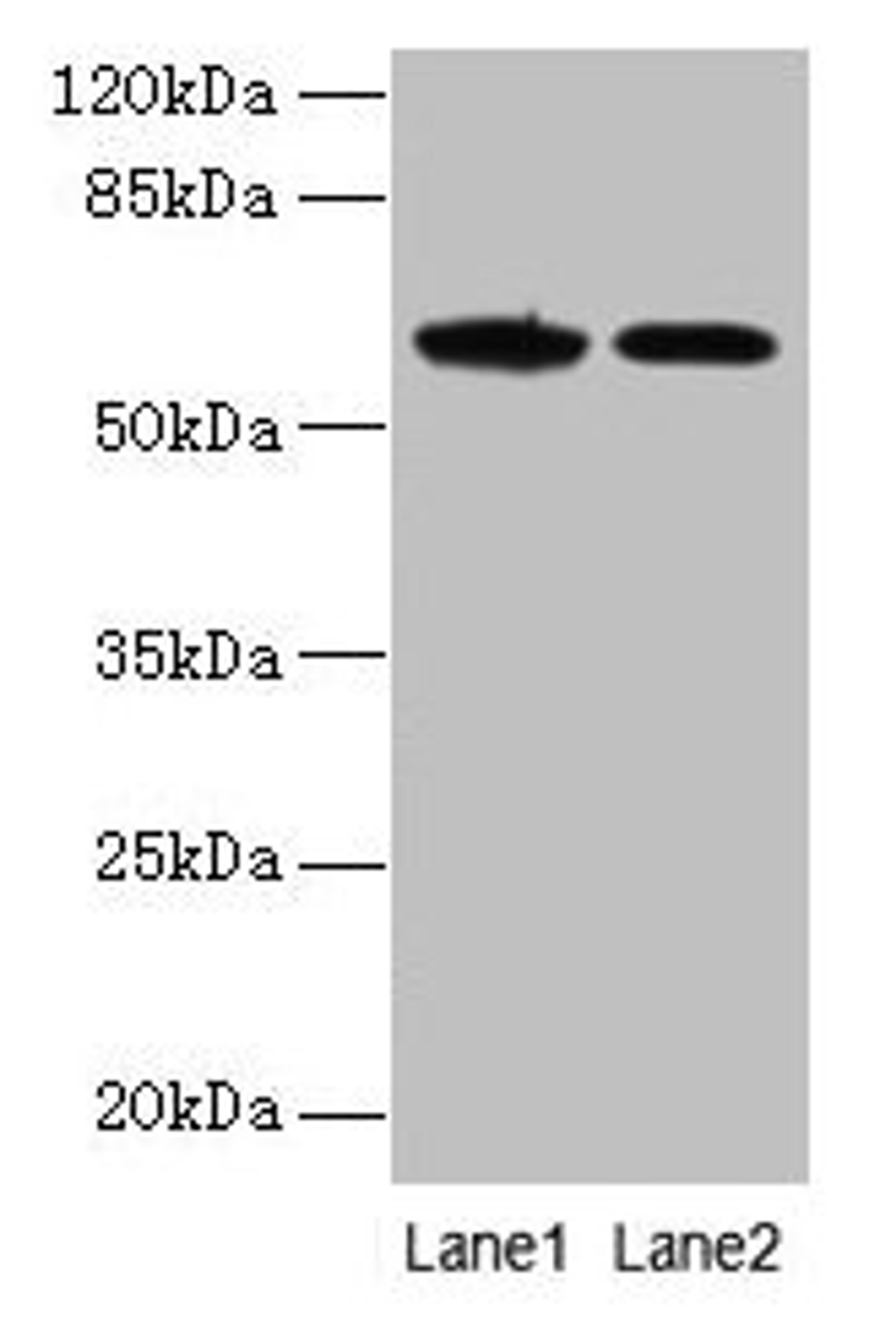 Western blot. All lanes: EGFL6 antibody at 6µg/ml. Lane 1: K562 whole cell lysate. Lane 2: Jurkat whole cell lysate. Secondary. Goat polyclonal to rabbit IgG at 1/10000 dilution. Predicted band size: 62 kDa. Observed band size: 62 kDa