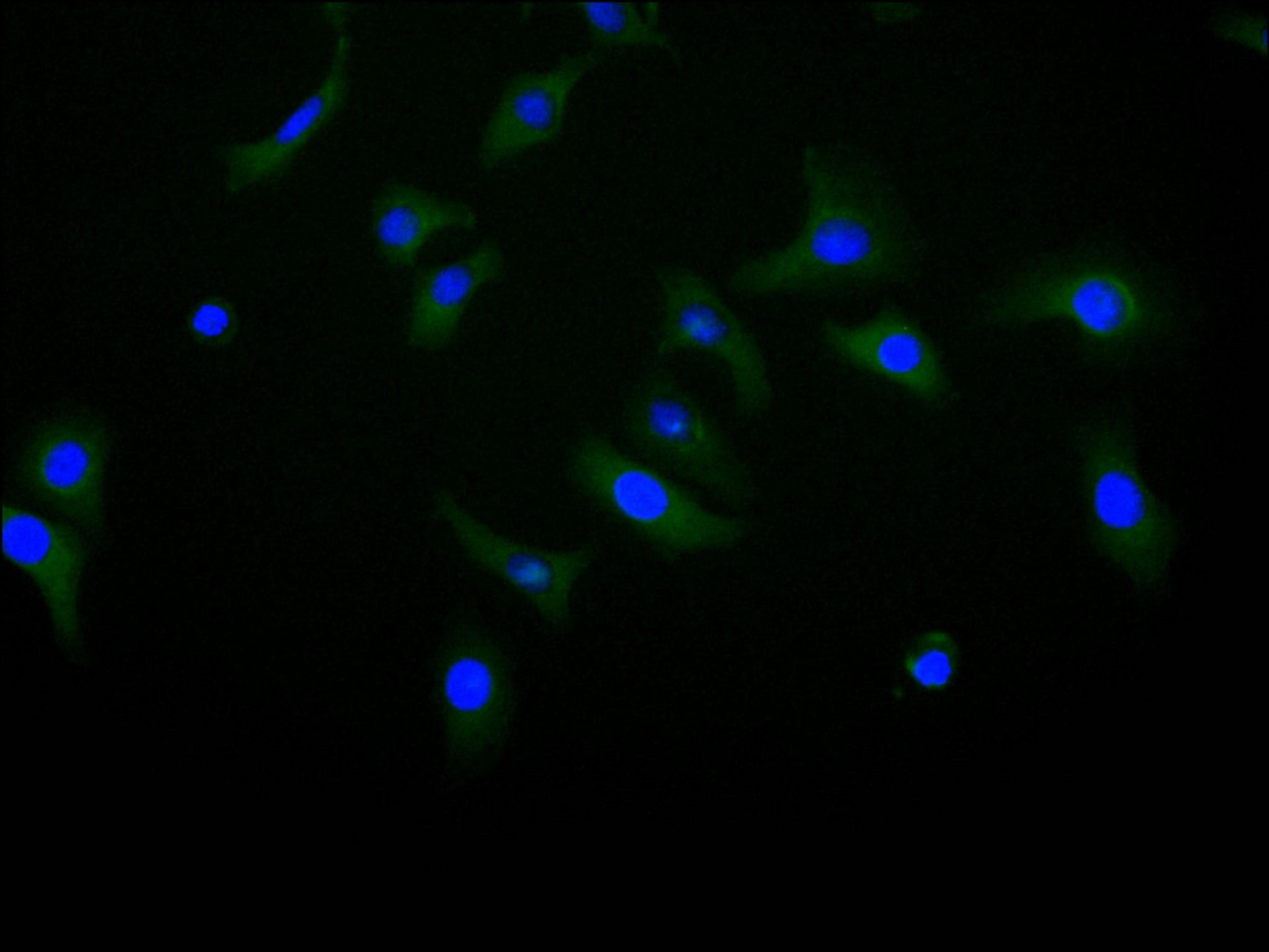 Immunofluorescence staining of Hela cell with CSB-RA005036MA1HU at 1:10, counter-stained with DAPI. The cells were fixed in 4% formaldehyde and blocked in 10% normal Goat Serum. The cells were then incubated with the antibody overnight at 4C. The secondary antibody was FITC-conjugated AffiniPure Goat Anti-Human IgG(H+L).