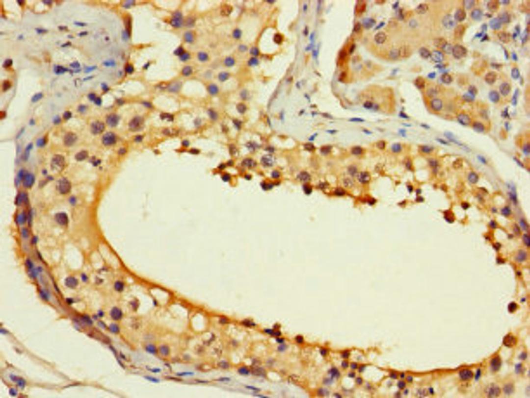 Immunohistochemistry of paraffin-embedded human testis tissue using CSB-PA878898LA01HU at dilution of 1:100
