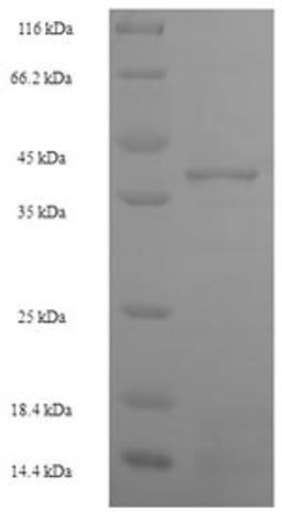 (Tris-Glycine gel) Discontinuous SDS-PAGE (reduced) with 5% enrichment gel and 15% separation gel.