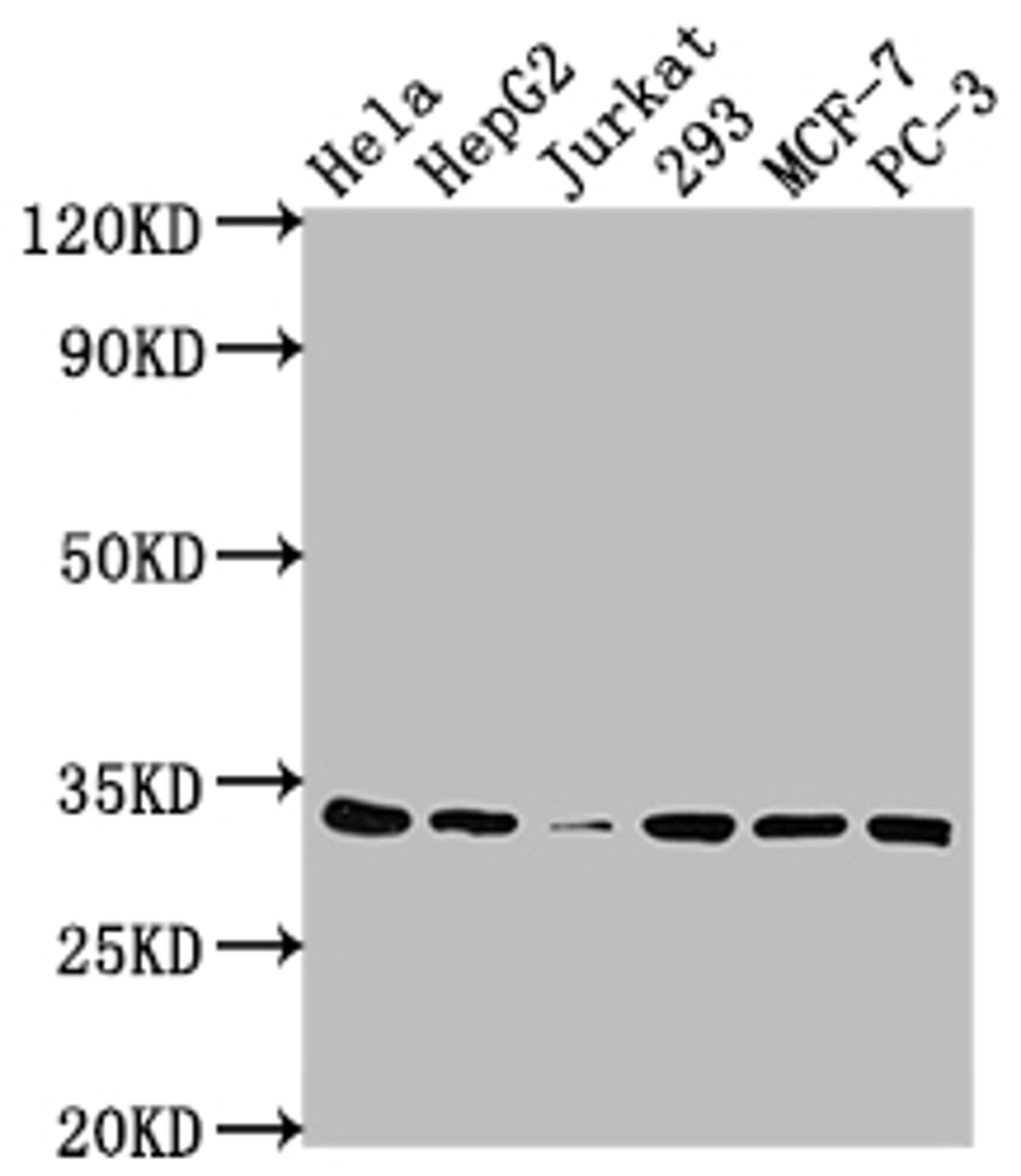 Western Blot. Positive WB detected in: Hela whole cell lysate, HepG2 whole cell lysate, Jurkat whole cell lysate, 293 whole cell lysate, MCF-7 whole cell lysate, PC-3 whole cell lysate. All lanes: CDK4 antibody at 1:2000. Secondary. Goat polyclonal to rabbit IgG at 1/50000 dilution. Predicted band size: 34, 21 kDa. Observed band size: 34 kDa.