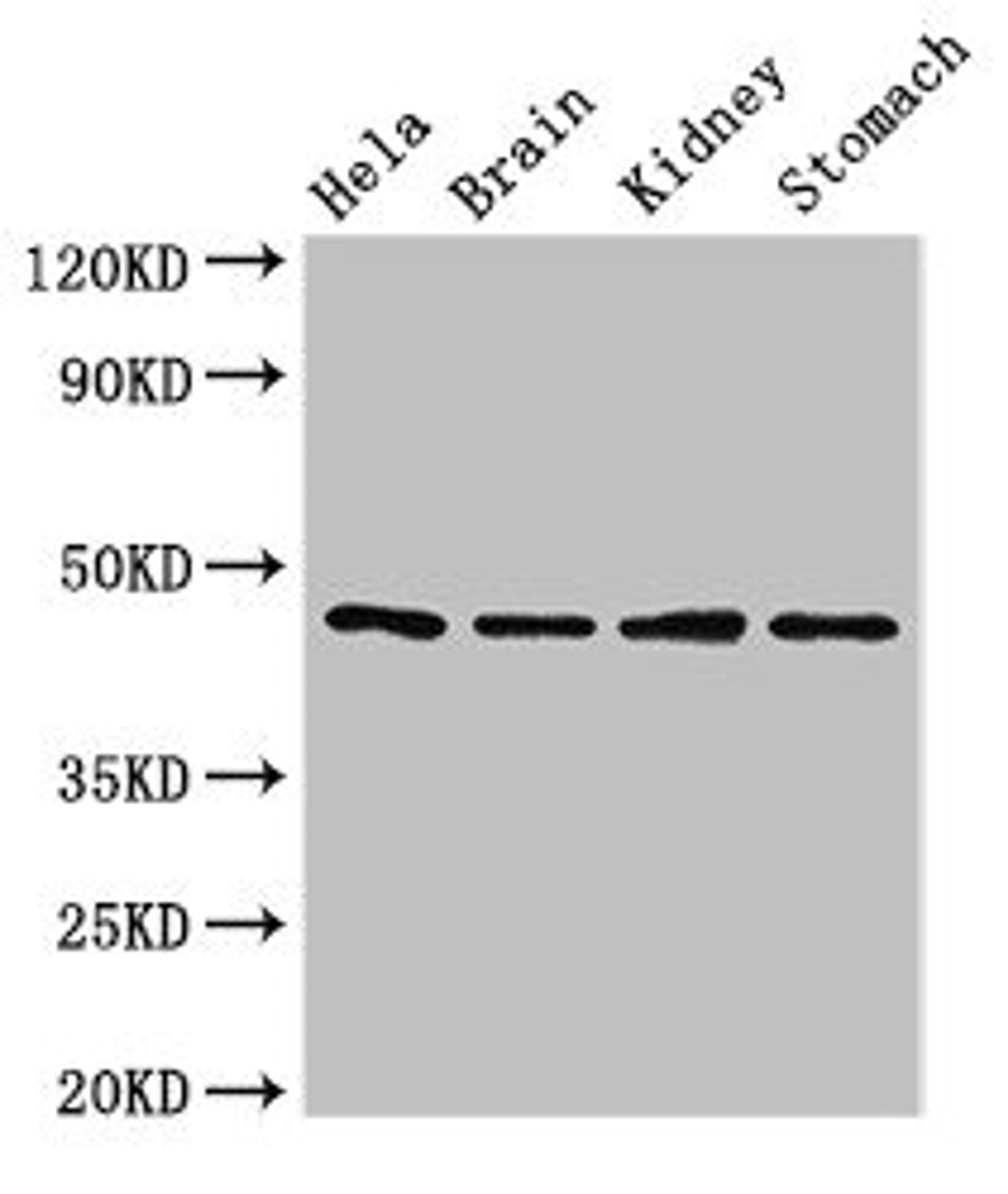 Western Blot. Positive WB detected in: Hela whole cell lysate, Mouse brain tissue, Mouse kidney tissue, Mouse stomach tissue. All lanes: NOB1 antibody at 1.5ug/ml. Secondary. Goat polyclonal to rabbit IgG at 1/50000 dilution. Predicted band size: 47 kDa. Observed band size: 47 kDa. 