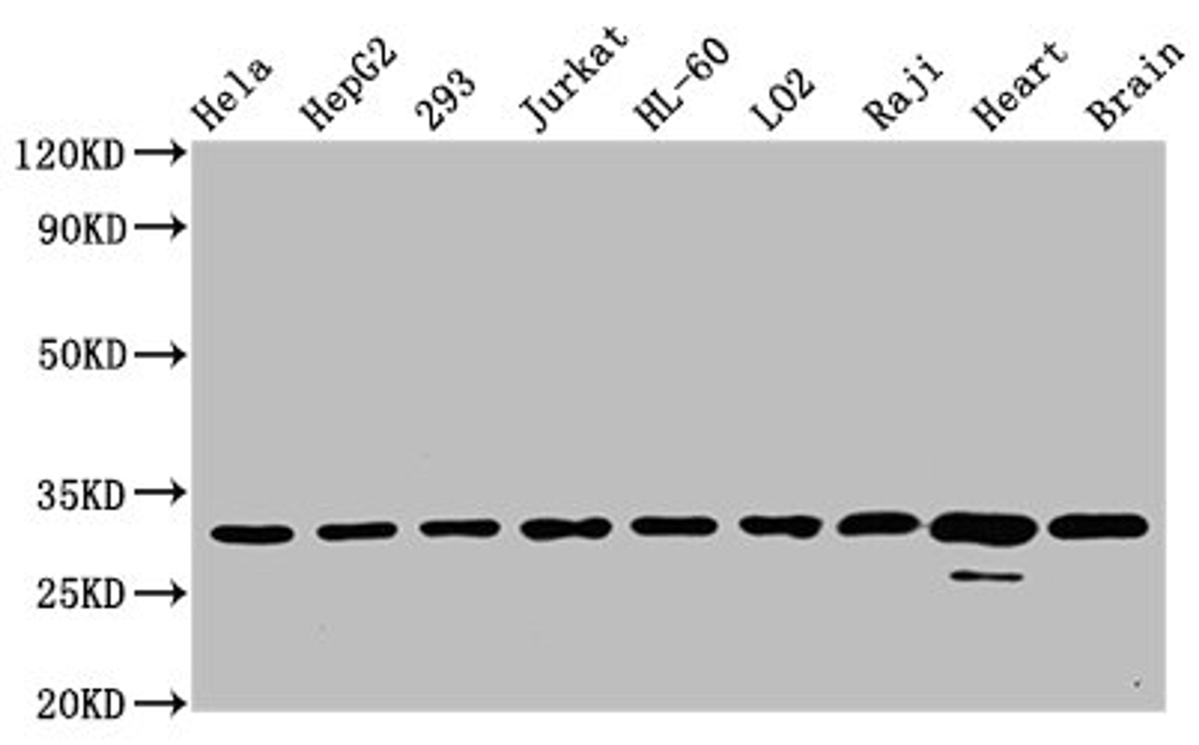 Western Blot. Positive WB detected in: Hela whole cell lysate, HepG2 whole cell lysate, 293 whole cell lysate, Jurkat whole cell lysate, HL-60 whole cell lysate, LO2 whole cell lysate, Raji whole cell lysate, Rat heart tissue, Mouse brain tissue. All lanes: VDAC1 antibody at 0.7μg/ml. Secondary. Goat polyclonal to rabbit IgG at 1/50000 dilution. Predicted band size: 31 KDa. Observed band size: 31 KDa. 