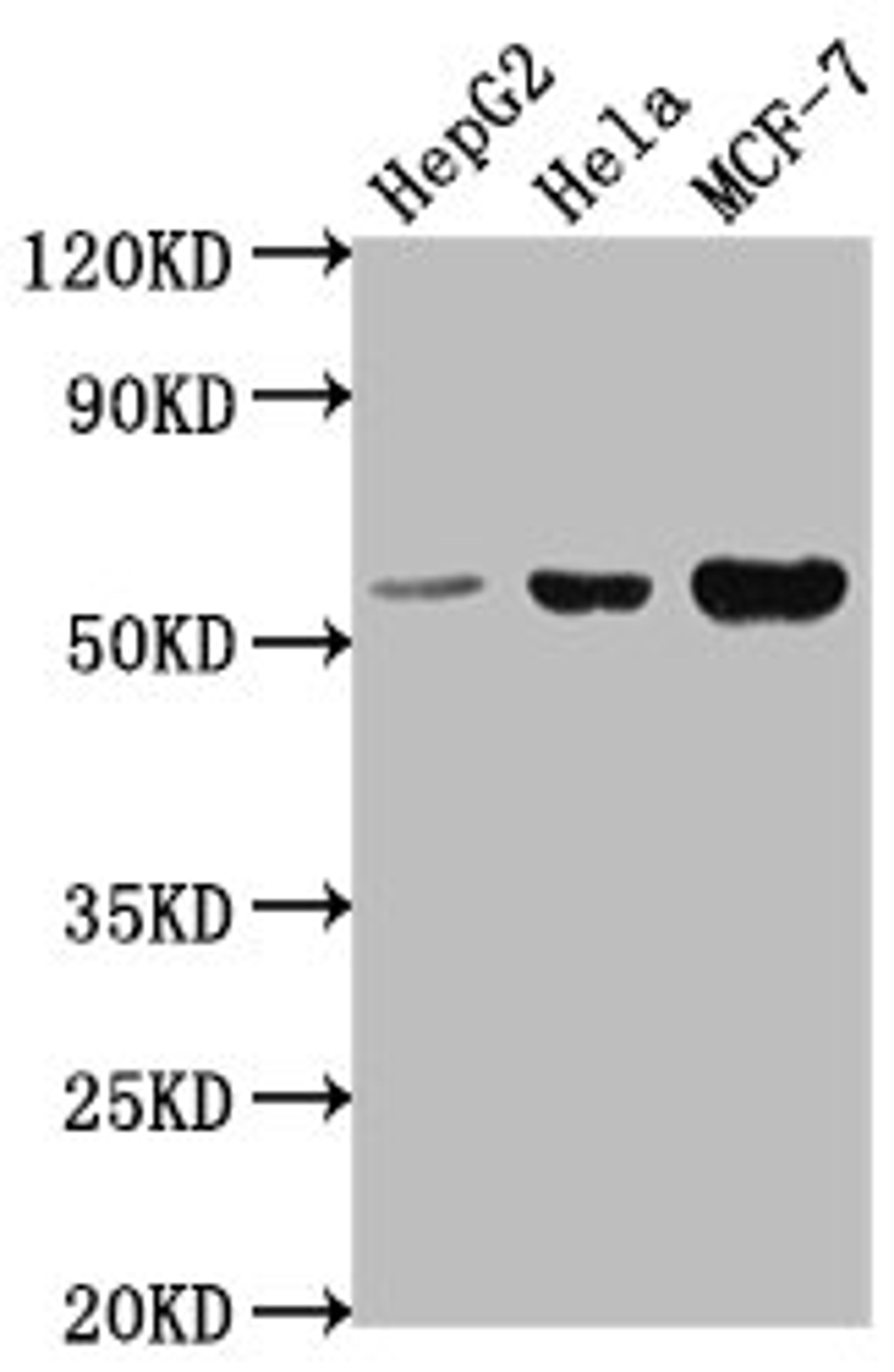 Western Blot. Positive WB detected in: HepG2 whole cell lysate, Hela whole cell lysate, MCF-7 whole cell lysate. All lanes: PRAMEF18 antibody at 1:2000. Secondary. Goat polyclonal to rabbit IgG at 1/50000 dilution. Predicted band size: 56 kDa. Observed band size: 56 kDa. 