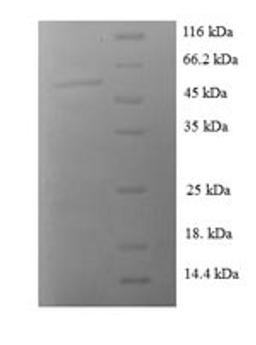 (Tris-Glycine gel) Discontinuous SDS-PAGE (reduced) with 5% enrichment gel and 15% separation gel.