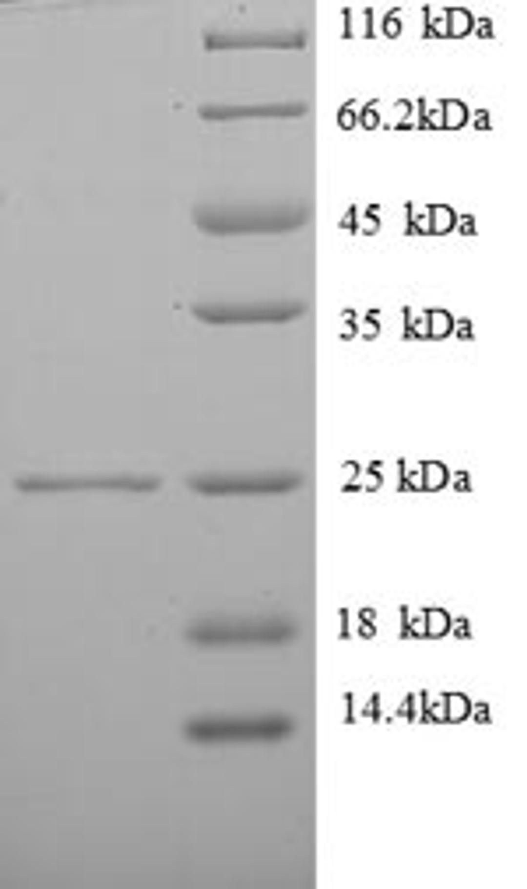 (Tris-Glycine gel) Discontinuous SDS-PAGE (reduced) with 5% enrichment gel and 15% separation gel.