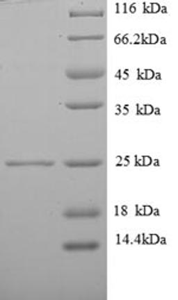 (Tris-Glycine gel) Discontinuous SDS-PAGE (reduced) with 5% enrichment gel and 15% separation gel.