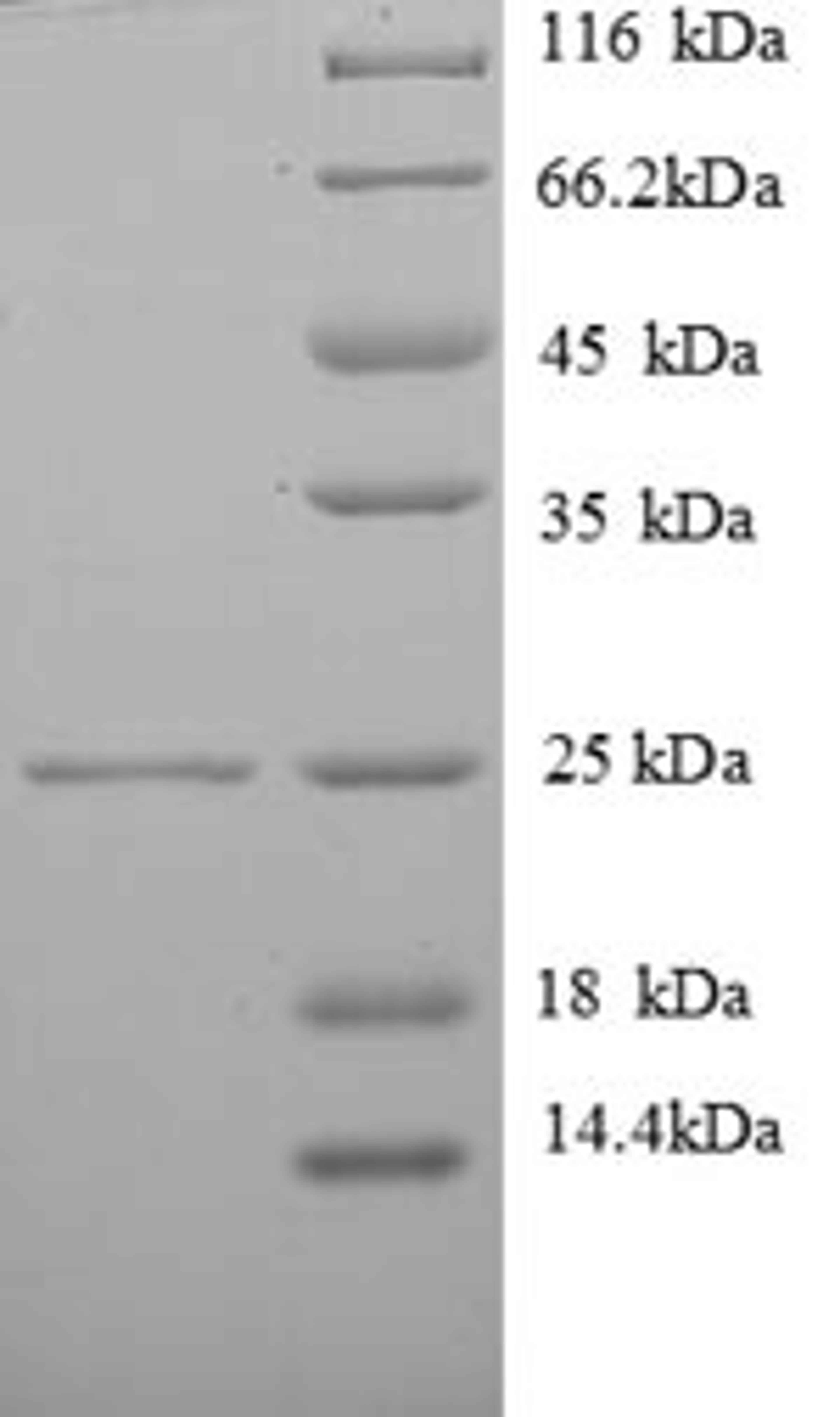 (Tris-Glycine gel) Discontinuous SDS-PAGE (reduced) with 5% enrichment gel and 15% separation gel.
