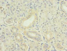 Immunohistochemistry of paraffin-embedded human pancreatic tissue using CSB-PA023987LA01HU at dilution of 1:100