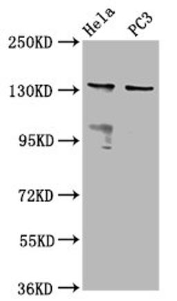 Western Blot. Positive WB detected in: Hela whole cell lysate, PC-3 whole cell lysate. All lanes: MOV10L1 antibody at 6.5µg/ml. Secondary. Goat polyclonal to rabbit IgG at 1/50000 dilution. Predicted band size: 136, 38, 14, 130, 131 kDa. Observed band size: 136 kDa