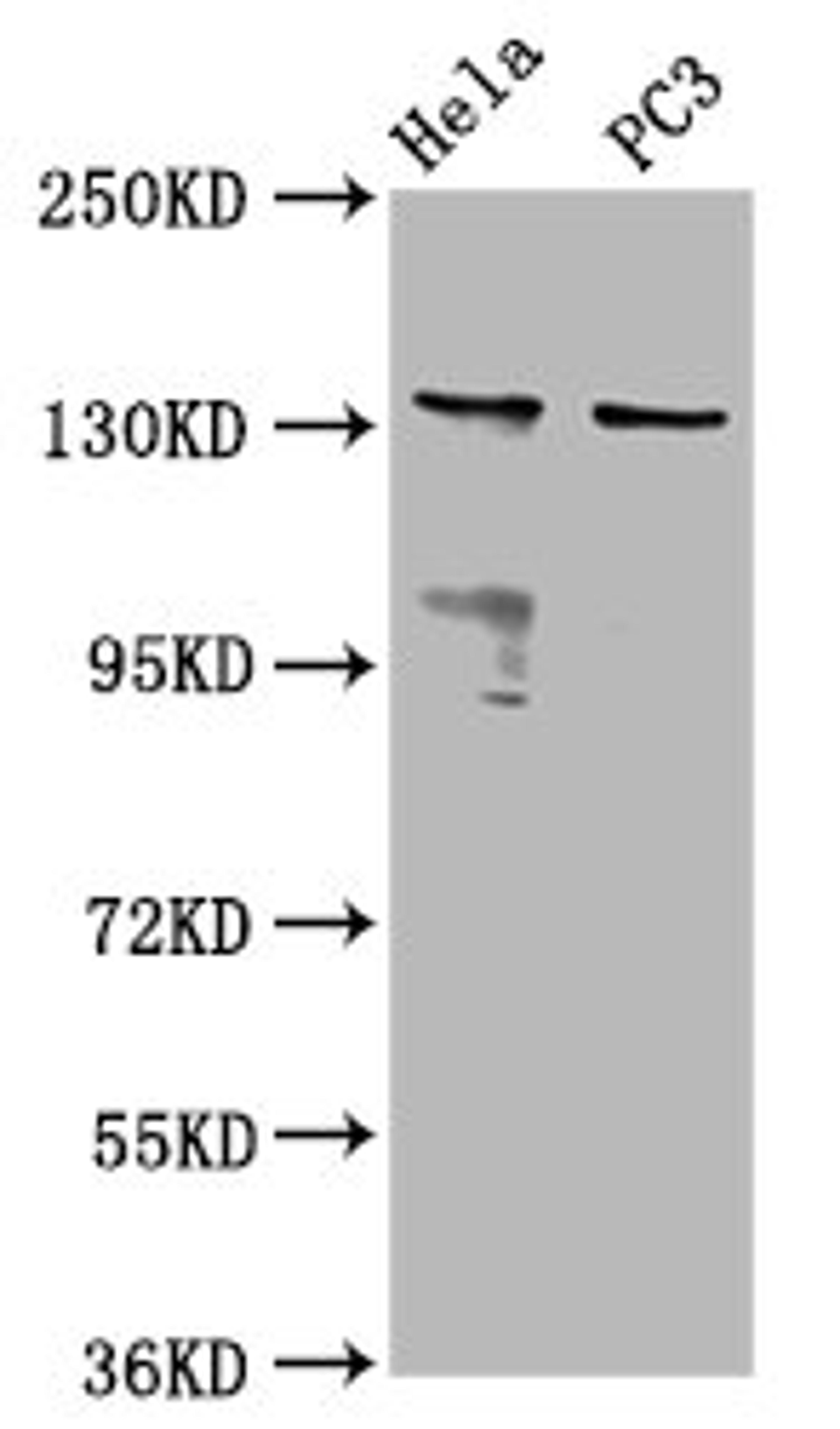 Western Blot. Positive WB detected in: Hela whole cell lysate, PC-3 whole cell lysate. All lanes: MOV10L1 antibody at 6.5µg/ml. Secondary. Goat polyclonal to rabbit IgG at 1/50000 dilution. Predicted band size: 136, 38, 14, 130, 131 kDa. Observed band size: 136 kDa