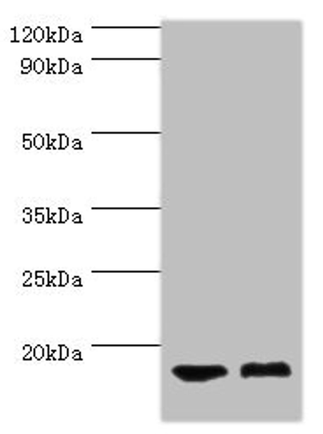 Western blot. All lanes: COTL1 antibody at 5ug/ml. Lane 1: Mouse brain tissue. Lane 2: Mouse kidney tissue. Secondary. Goat polyclonal to rabbit IgG at 1/10000 dilution. Predicted band size: 16 kDa. Observed band size: 16 kDa. 