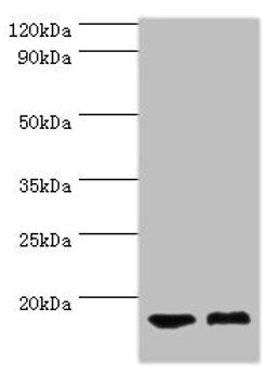 Western blot. All lanes: COTL1 antibody at 5ug/ml. Lane 1: Mouse brain tissue. Lane 2: Mouse kidney tissue. Secondary. Goat polyclonal to rabbit IgG at 1/10000 dilution. Predicted band size: 16 kDa. Observed band size: 16 kDa. 