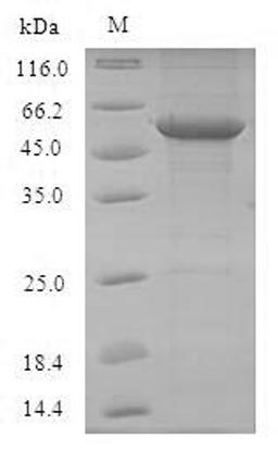 (Tris-Glycine gel) Discontinuous SDS-PAGE (reduced) with 5% enrichment gel and 15% separation gel.