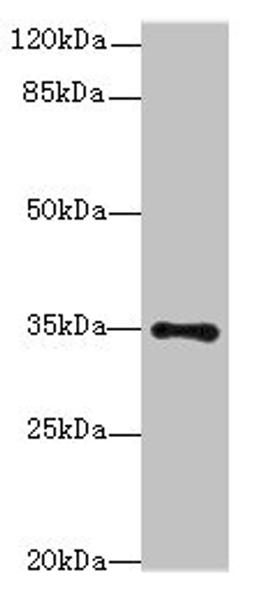 Western blot. All lanes: MED27 antibody at 0.5µg/ml + A431 whole cell lysate. Secondary. Goat polyclonal to rabbit IgG at 1/10000 dilution. Predicted band size: 36, 32, 15 kDa. Observed band size: 36 kDa