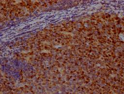 IHC image of CSB-RA209144A0HU diluted at 1:100 and staining in paraffin-embedded human tonsil tissue performed on a Leica BondTM system. After dewaxing and hydration, antigen retrieval was mediated by high pressure in a citrate buffer (pH 6.0). Section was blocked with 10% normal goat serum 30min at RT. Then primary antibody (1% BSA) was incubated at 4℃ overnight. The primary is detected by a Goat anti-rabbit IgG polymer labeled by HRP and visualized using 0.05% DAB.