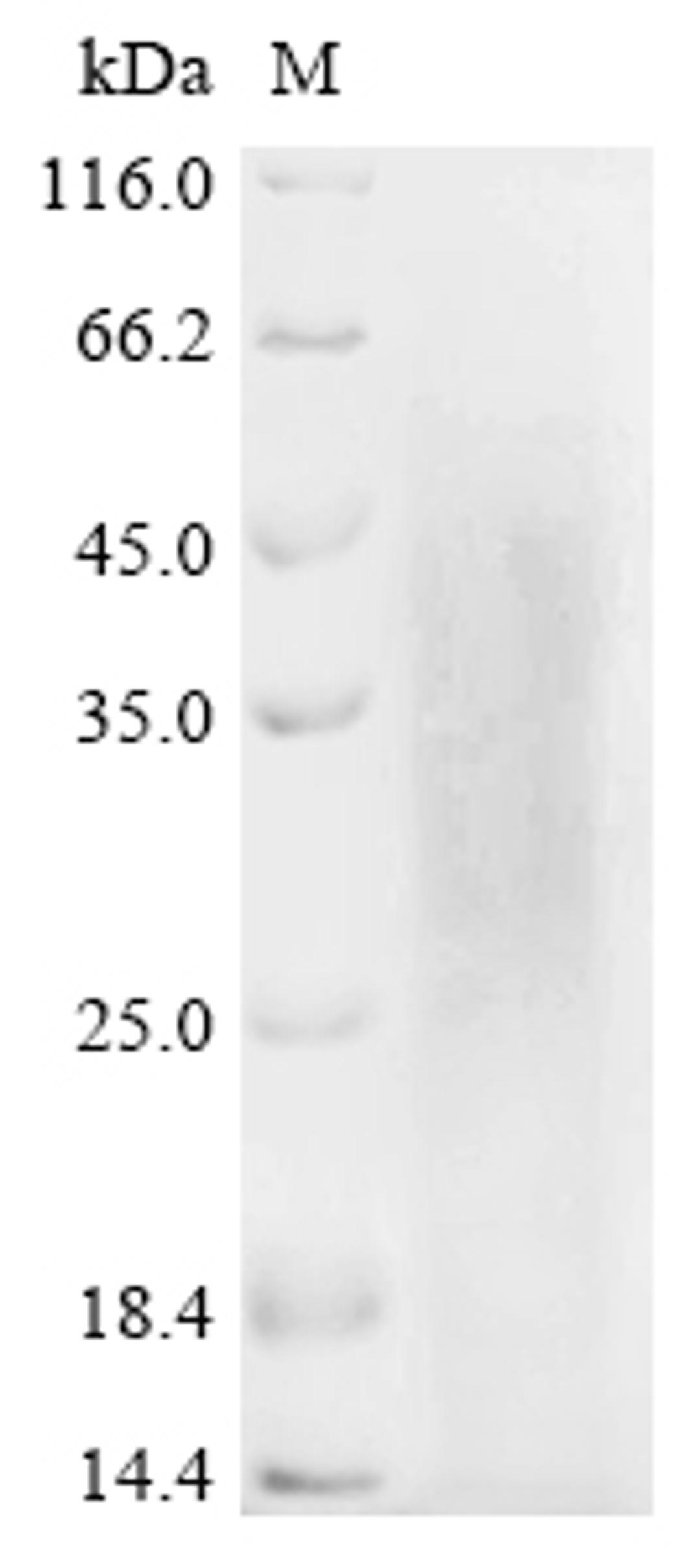(Tris-Glycine gel) Discontinuous SDS-PAGE (reduced) with 5% enrichment gel and 15% separation gel.