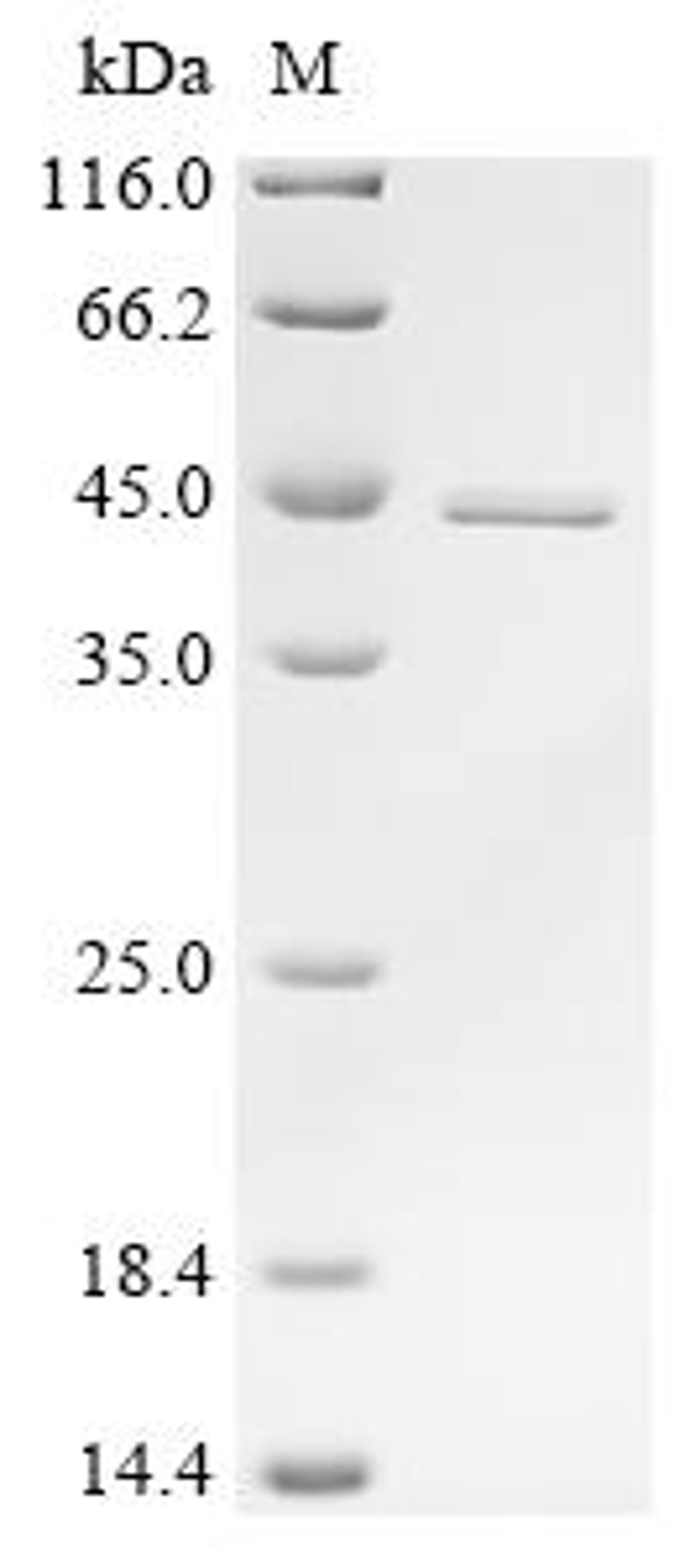 (Tris-Glycine gel) Discontinuous SDS-PAGE (reduced) with 5% enrichment gel and 15% separation gel.