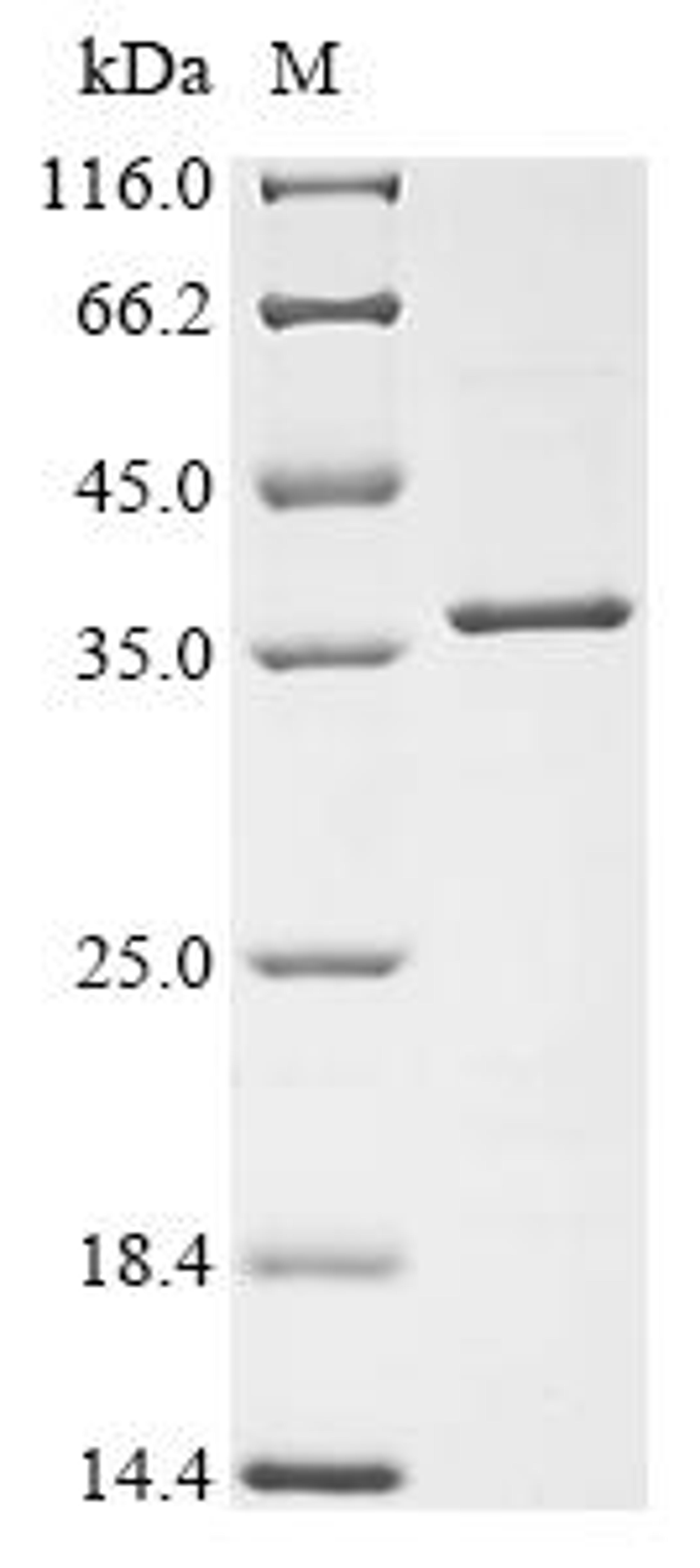 (Tris-Glycine gel) Discontinuous SDS-PAGE (reduced) with 5% enrichment gel and 15% separation gel.