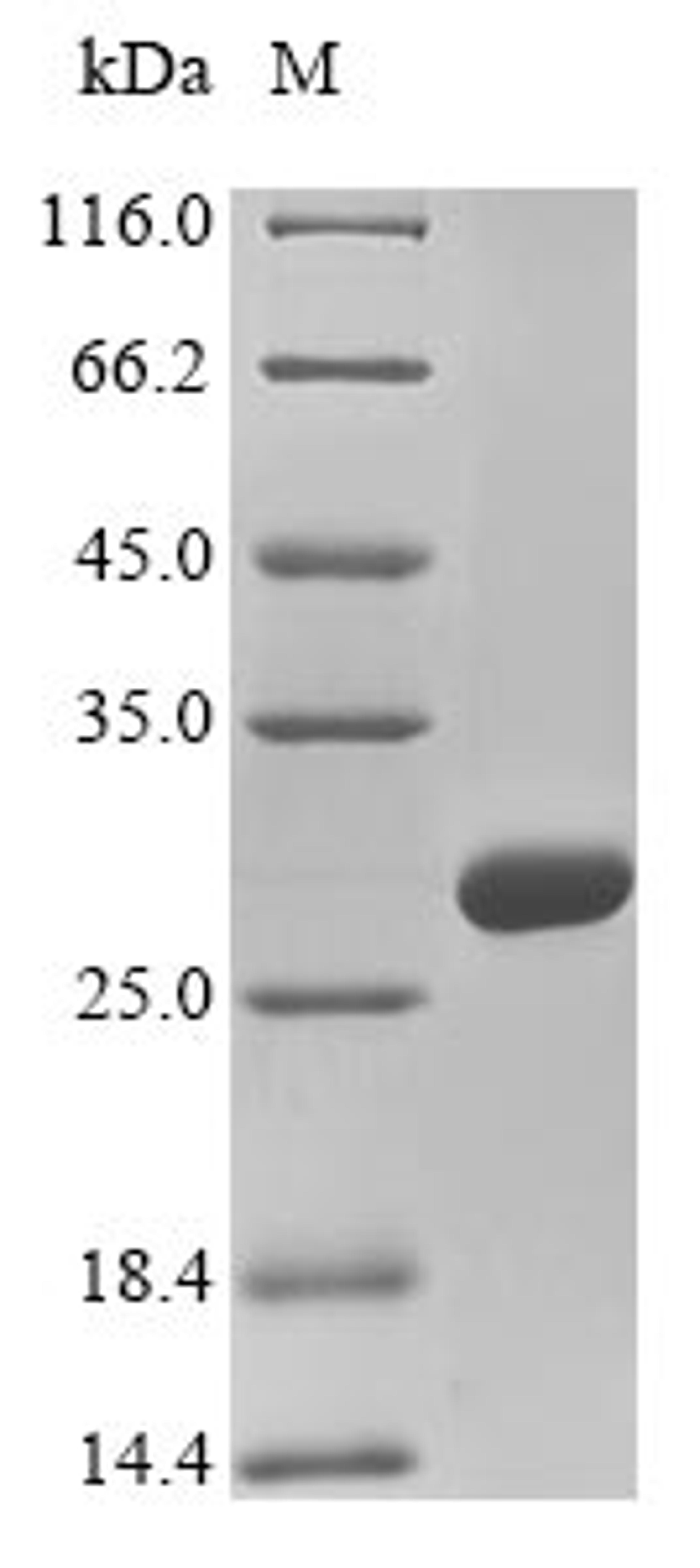 (Tris-Glycine gel) Discontinuous SDS-PAGE (reduced) with 5% enrichment gel and 15% separation gel.