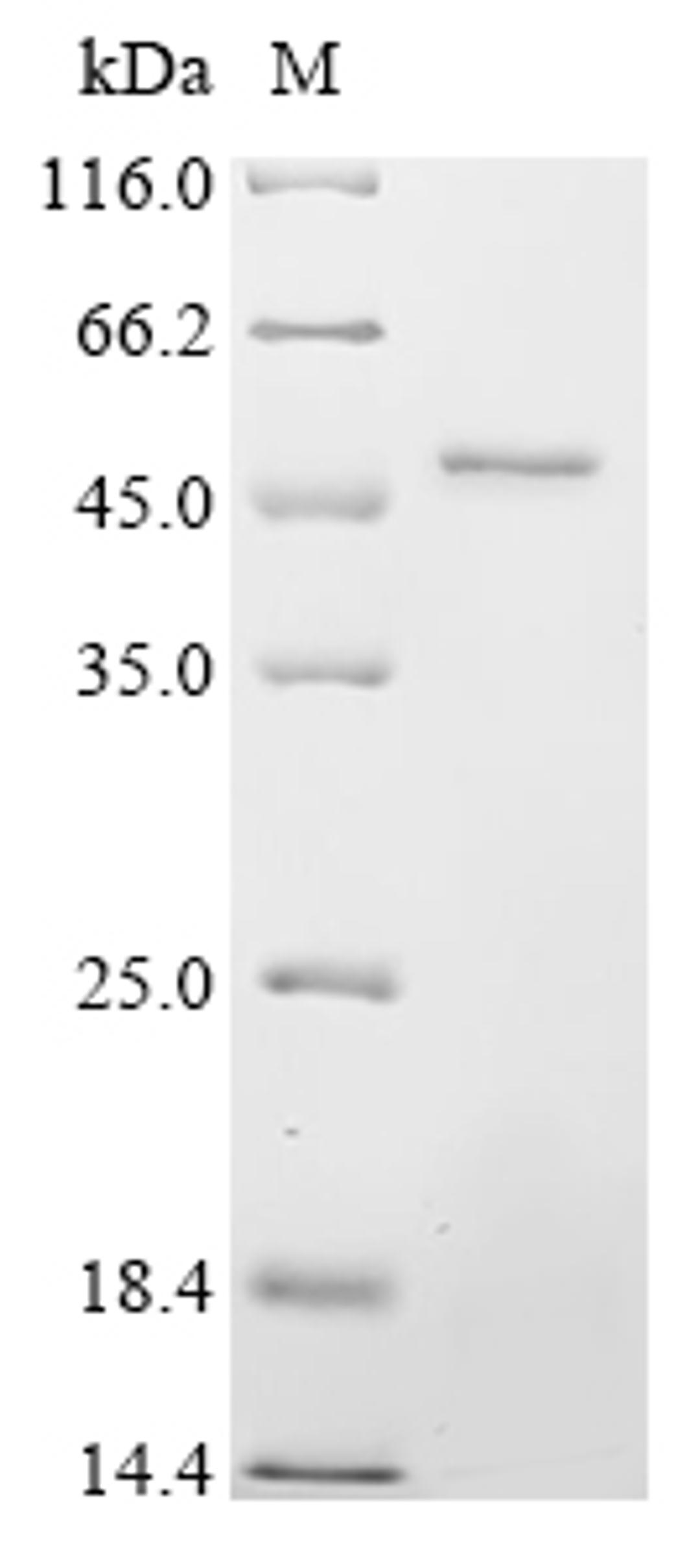 (Tris-Glycine gel) Discontinuous SDS-PAGE (reduced) with 5% enrichment gel and 15% separation gel.