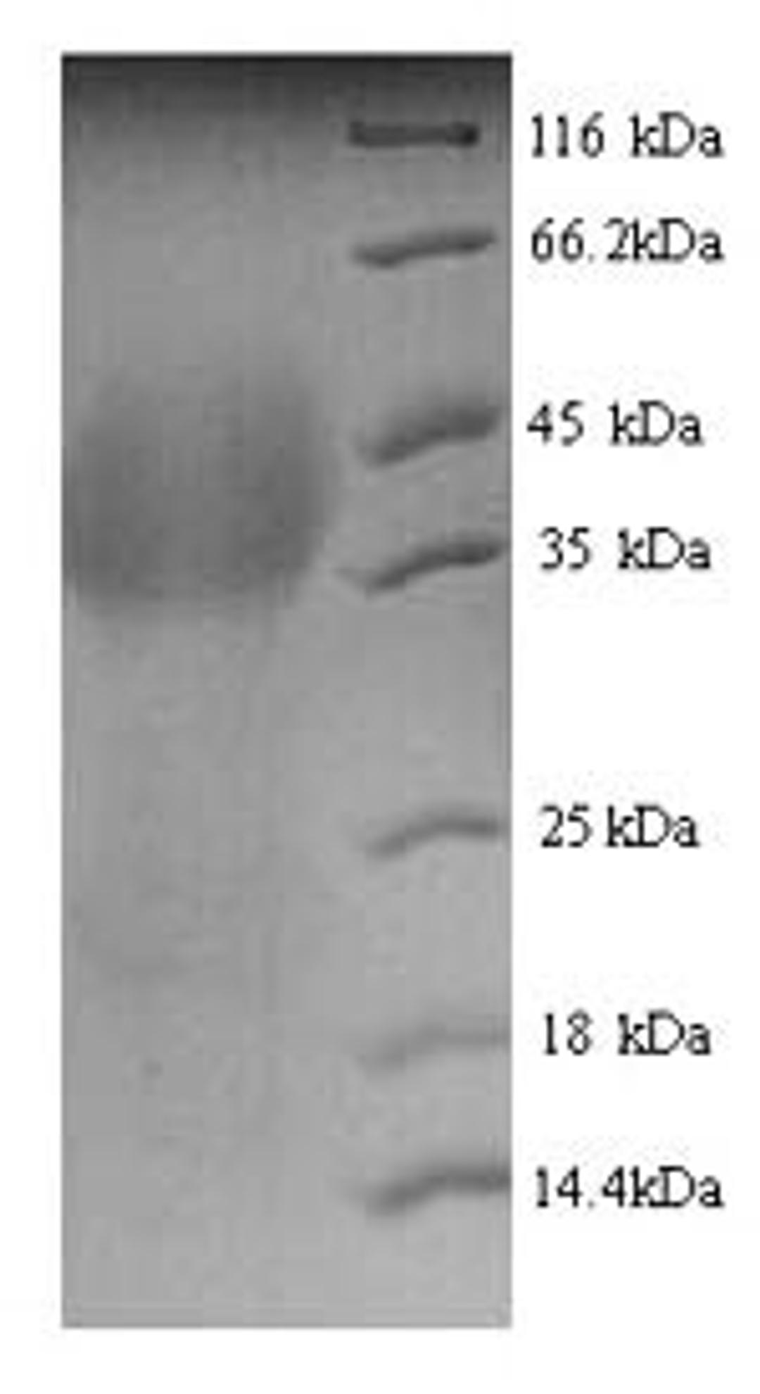 (Tris-Glycine gel) Discontinuous SDS-PAGE (reduced) with 5% enrichment gel and 15% separation gel.