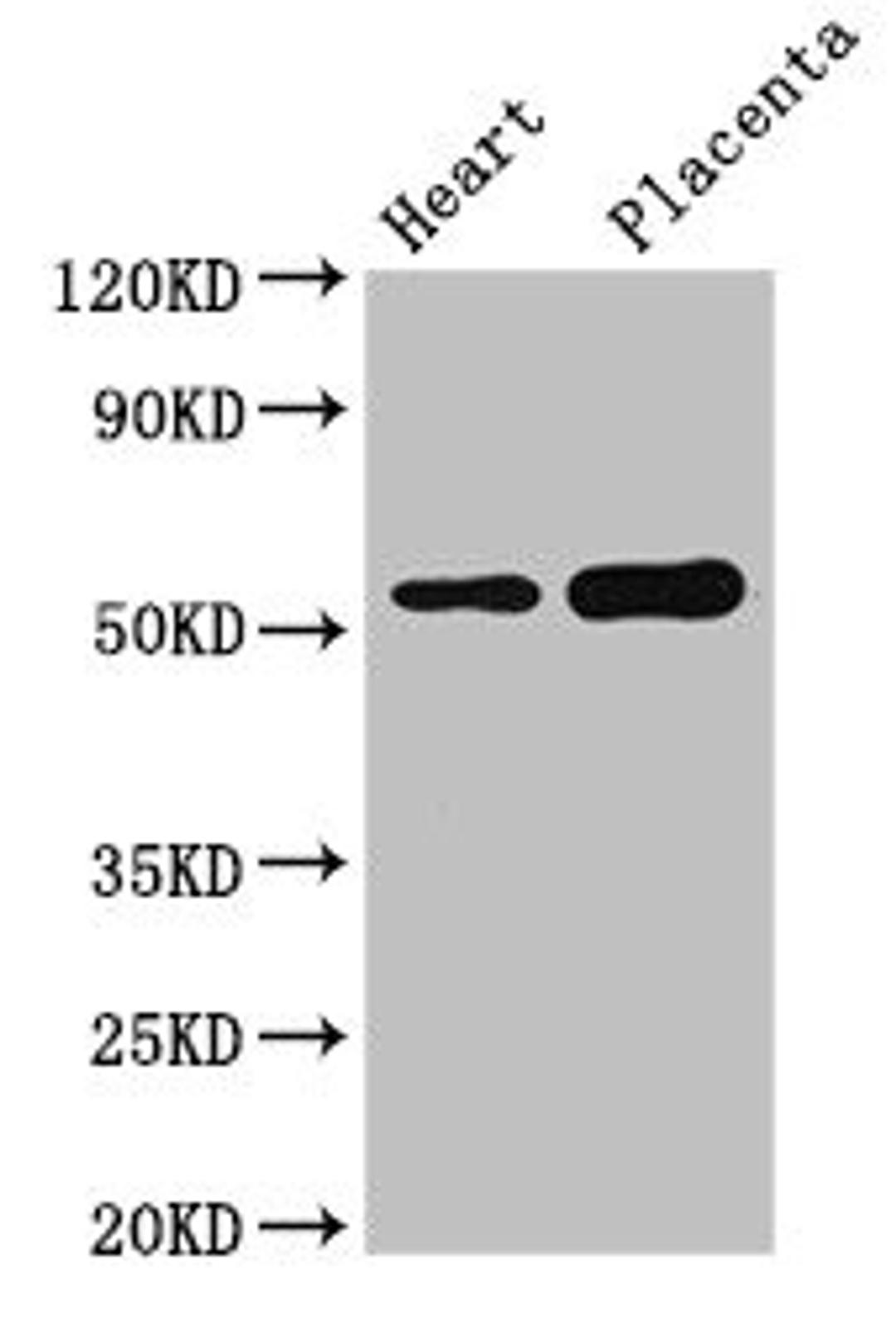 Western Blot. Positive WB detected in: Mouse heart tissue, Human placenta tissue. All lanes: DOK3 antibody at 3µg/ml. Secondary. Goat polyclonal to rabbit IgG at 1/50000 dilution. Predicted band size: 54, 24, 36, 25 kDa. Observed band size: 54 kDa