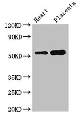 Western Blot. Positive WB detected in: Mouse heart tissue, Human placenta tissue. All lanes: DOK3 antibody at 3µg/ml. Secondary. Goat polyclonal to rabbit IgG at 1/50000 dilution. Predicted band size: 54, 24, 36, 25 kDa. Observed band size: 54 kDa