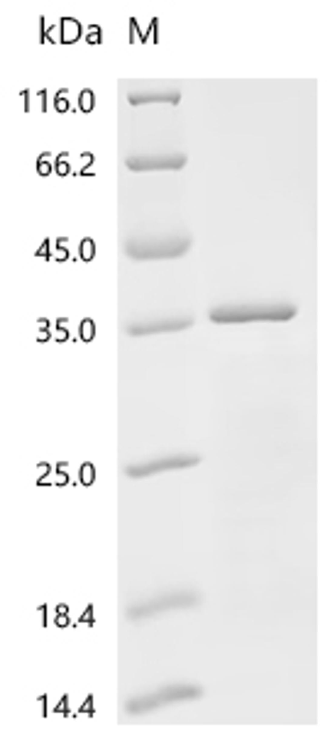 (Tris-Glycine gel) Discontinuous SDS-PAGE (reduced) with 5% enrichment gel and 15% separation gel.