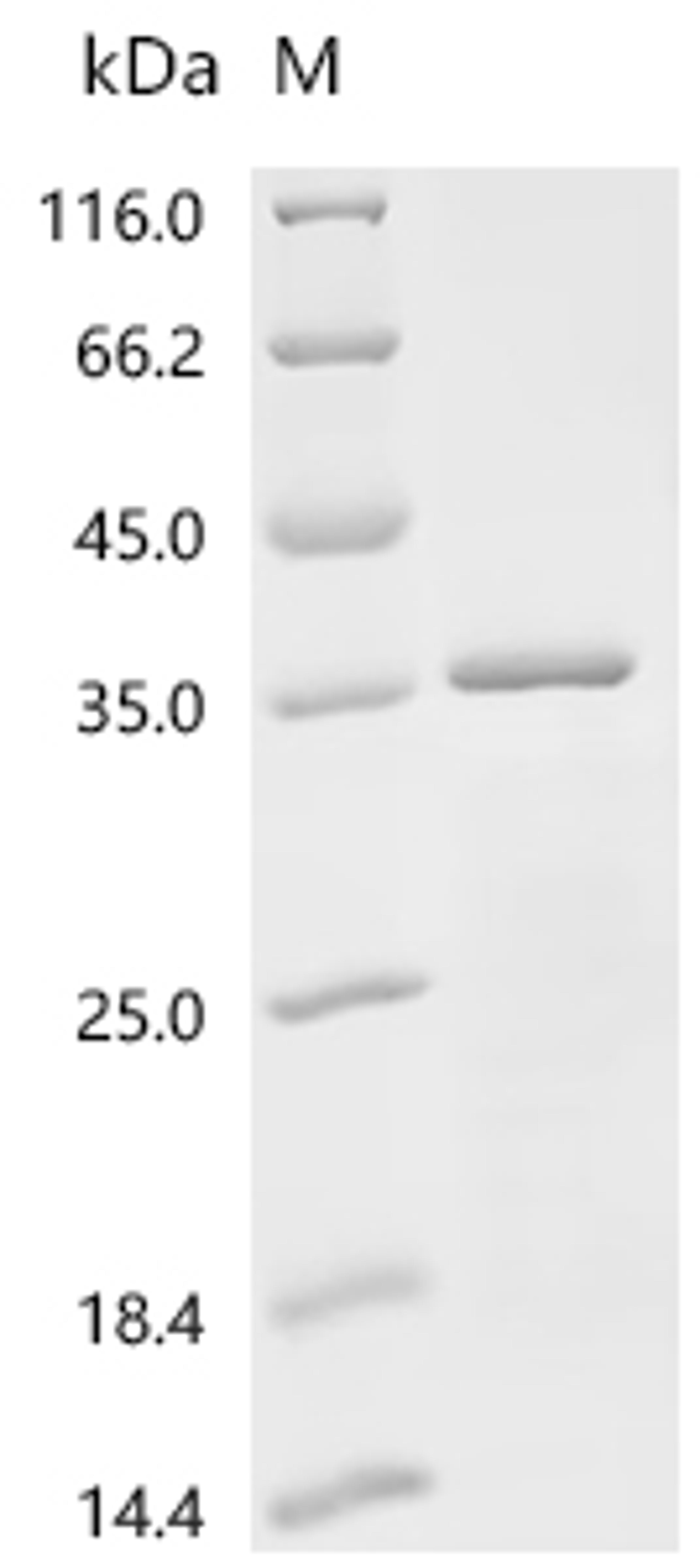 (Tris-Glycine gel) Discontinuous SDS-PAGE (reduced) with 5% enrichment gel and 15% separation gel.