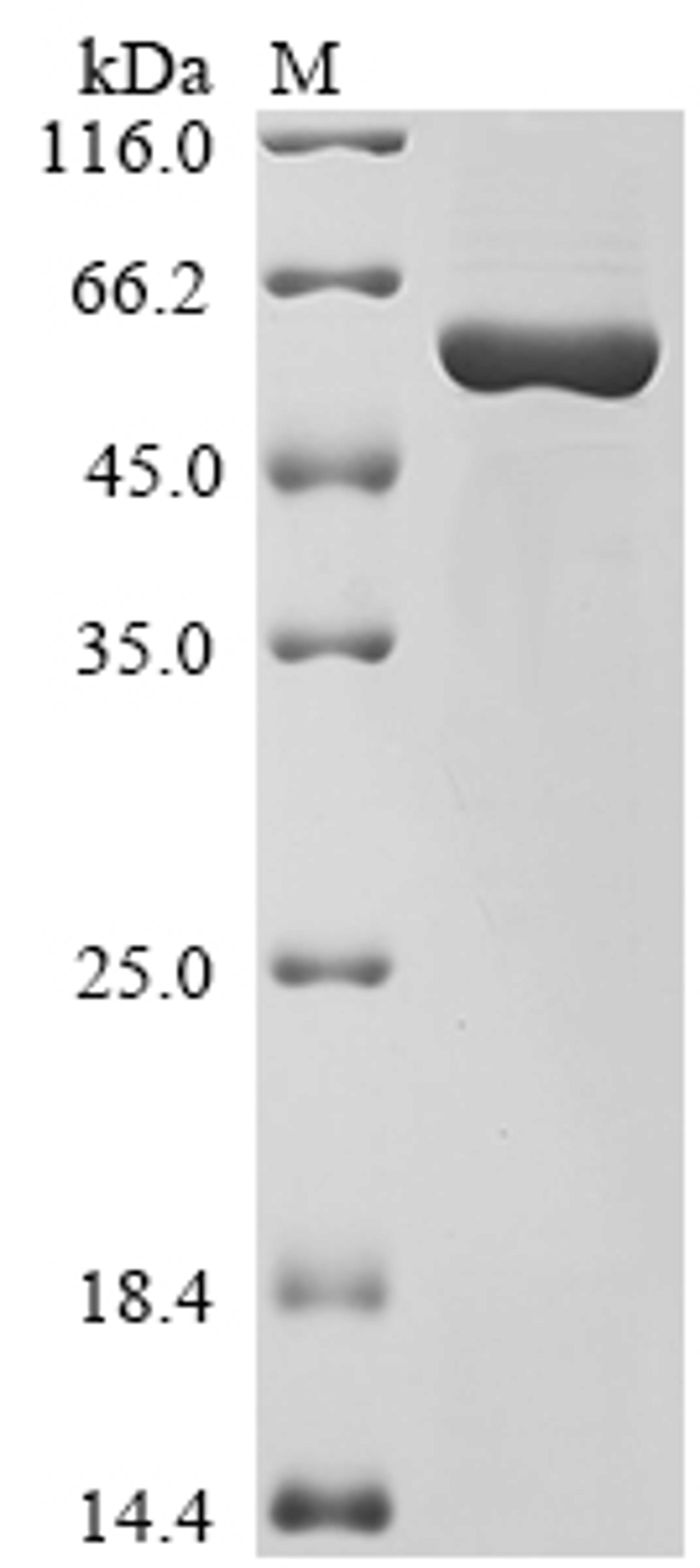 (Tris-Glycine gel) Discontinuous SDS-PAGE (reduced) with 5% enrichment gel and 15% separation gel.