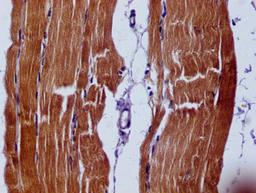 IHC image of CSB-MA021780A0m diluted at 1:60 and staining in paraffin-embedded human skeletal muscle tissue performed on a Leica BondTM system. After dewaxing and hydration, antigen retrieval was mediated by high pressure in a citrate buffer (pH 6.0). Section was blocked with 10% normal goat serum 30min at RT. Then primary antibody (1% BSA) was incubated at 4°C overnight. The primary is detected by a biotinylated secondary antibody and visualized using an HRP conjugated SP system.