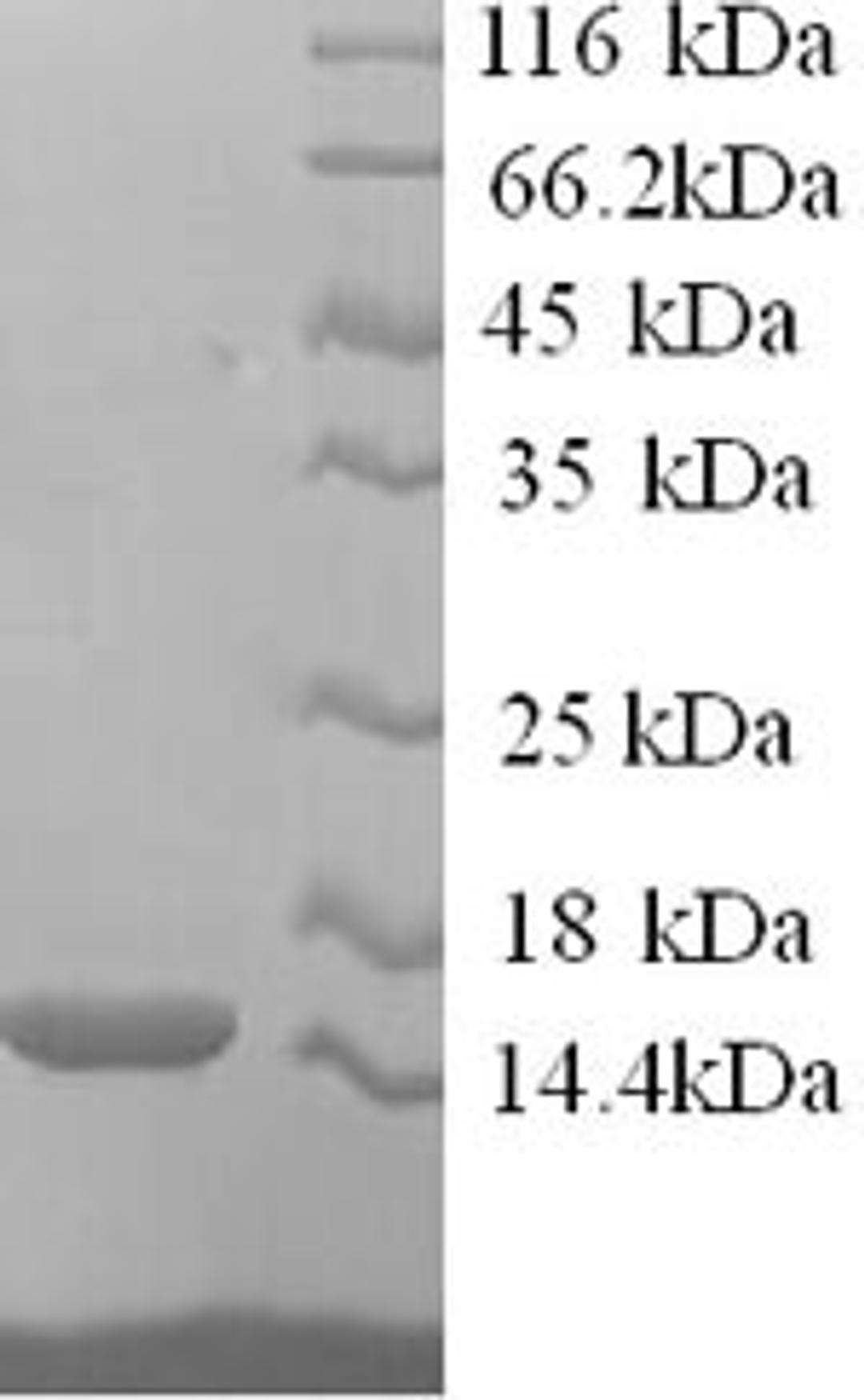 (Tris-Glycine gel) Discontinuous SDS-PAGE (reduced) with 5% enrichment gel and 15% separation gel.
